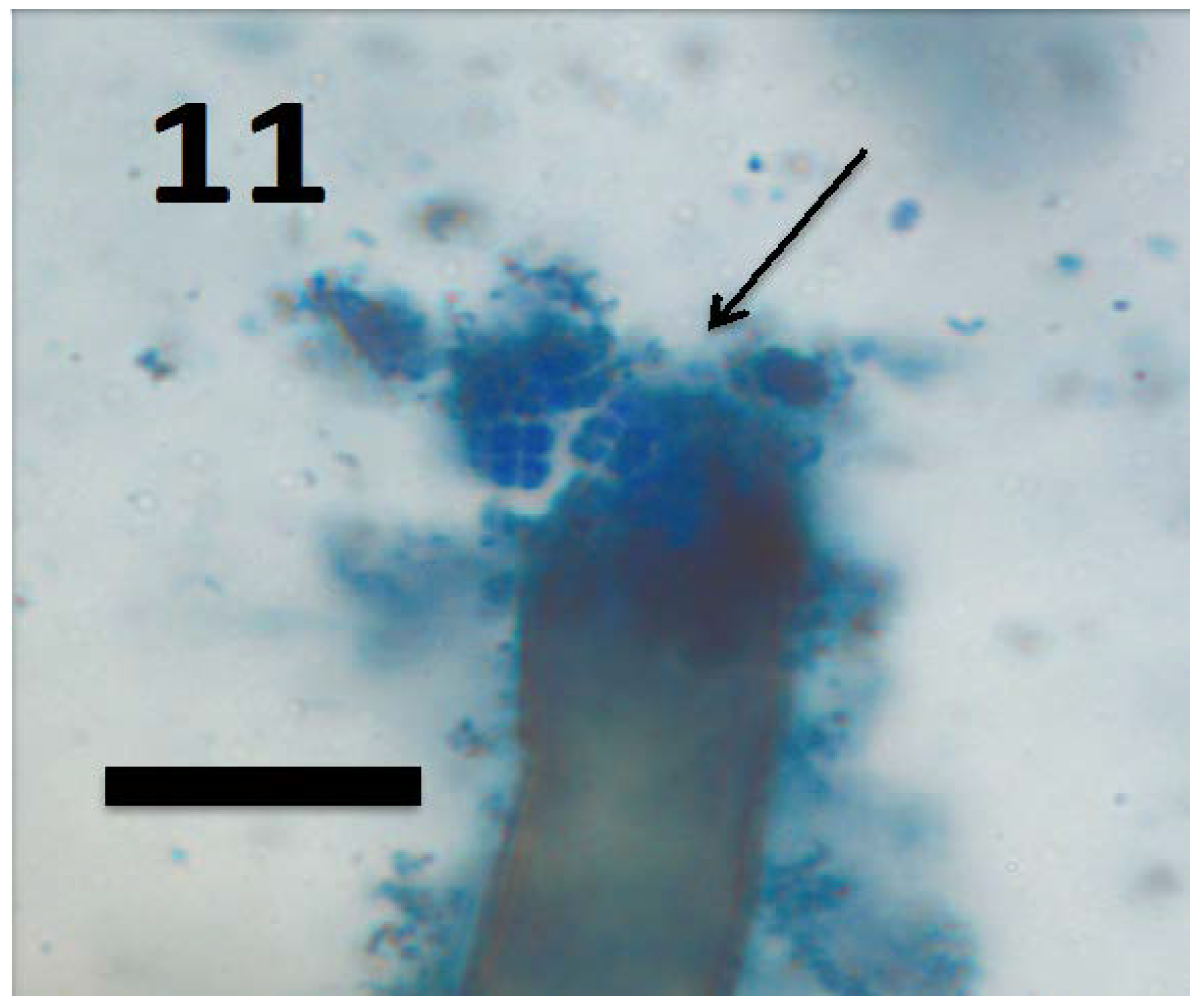 Microorganisms 06 00095 g011