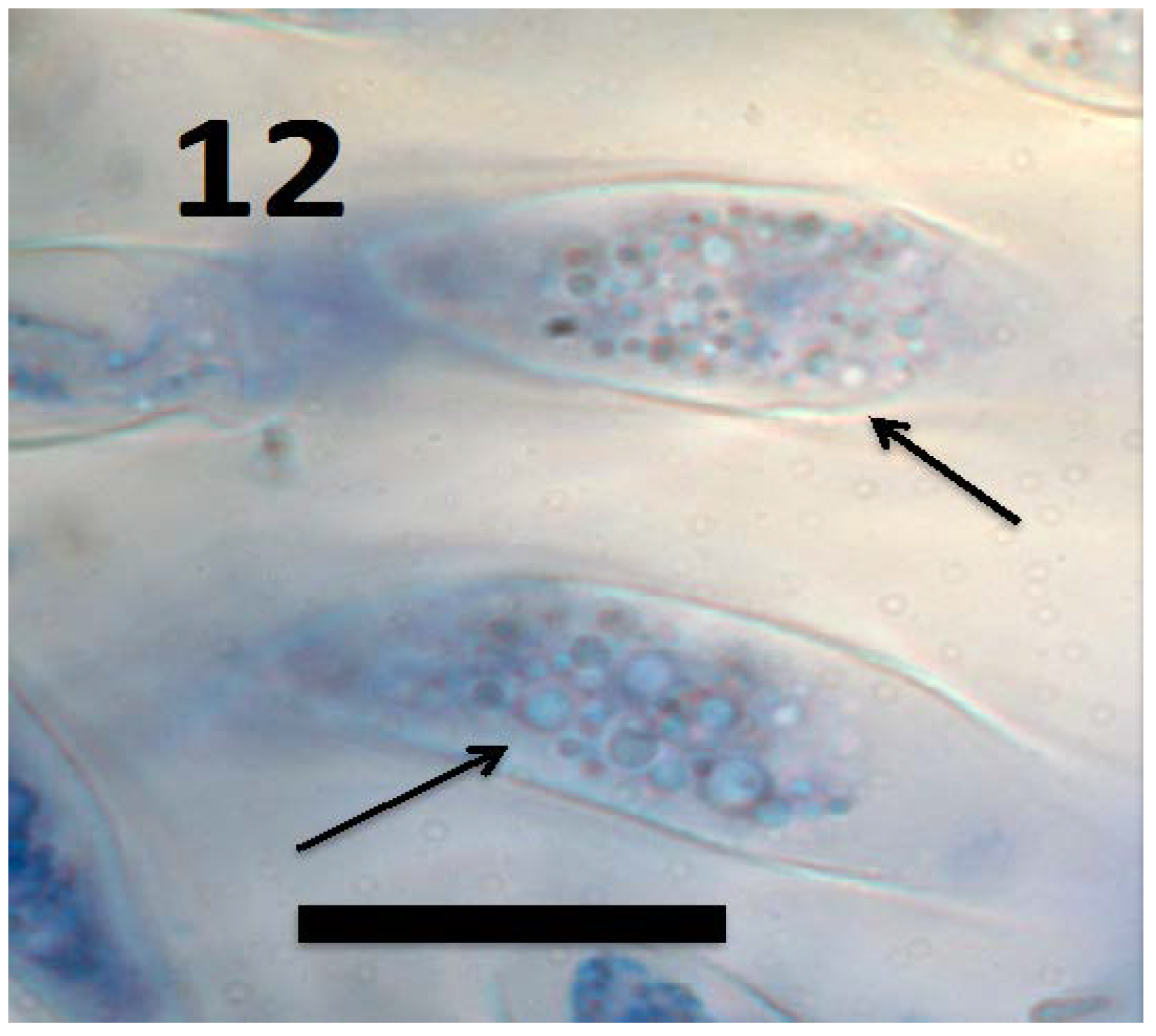 Microorganisms 06 00095 g012