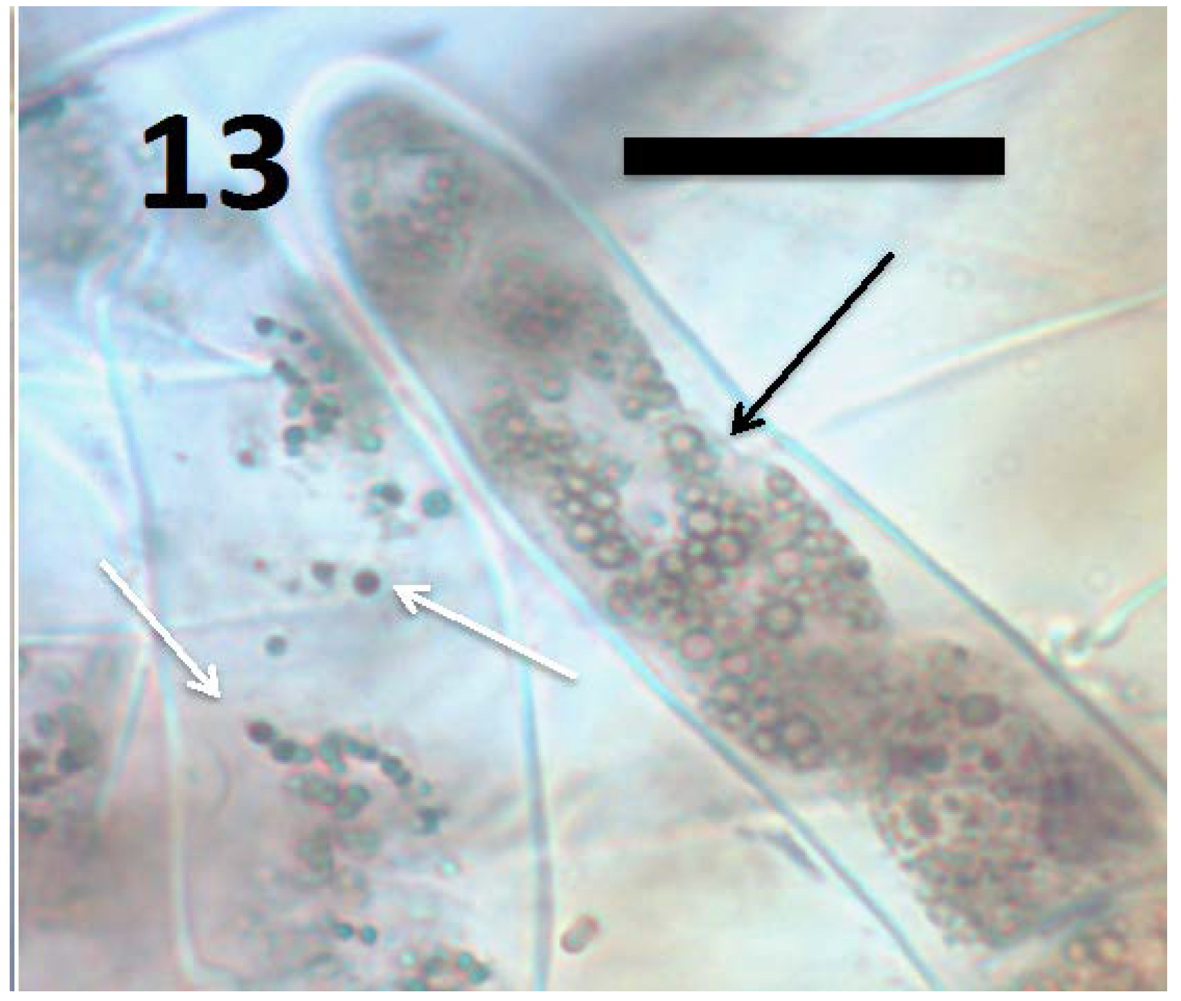 Microorganisms 06 00095 g013