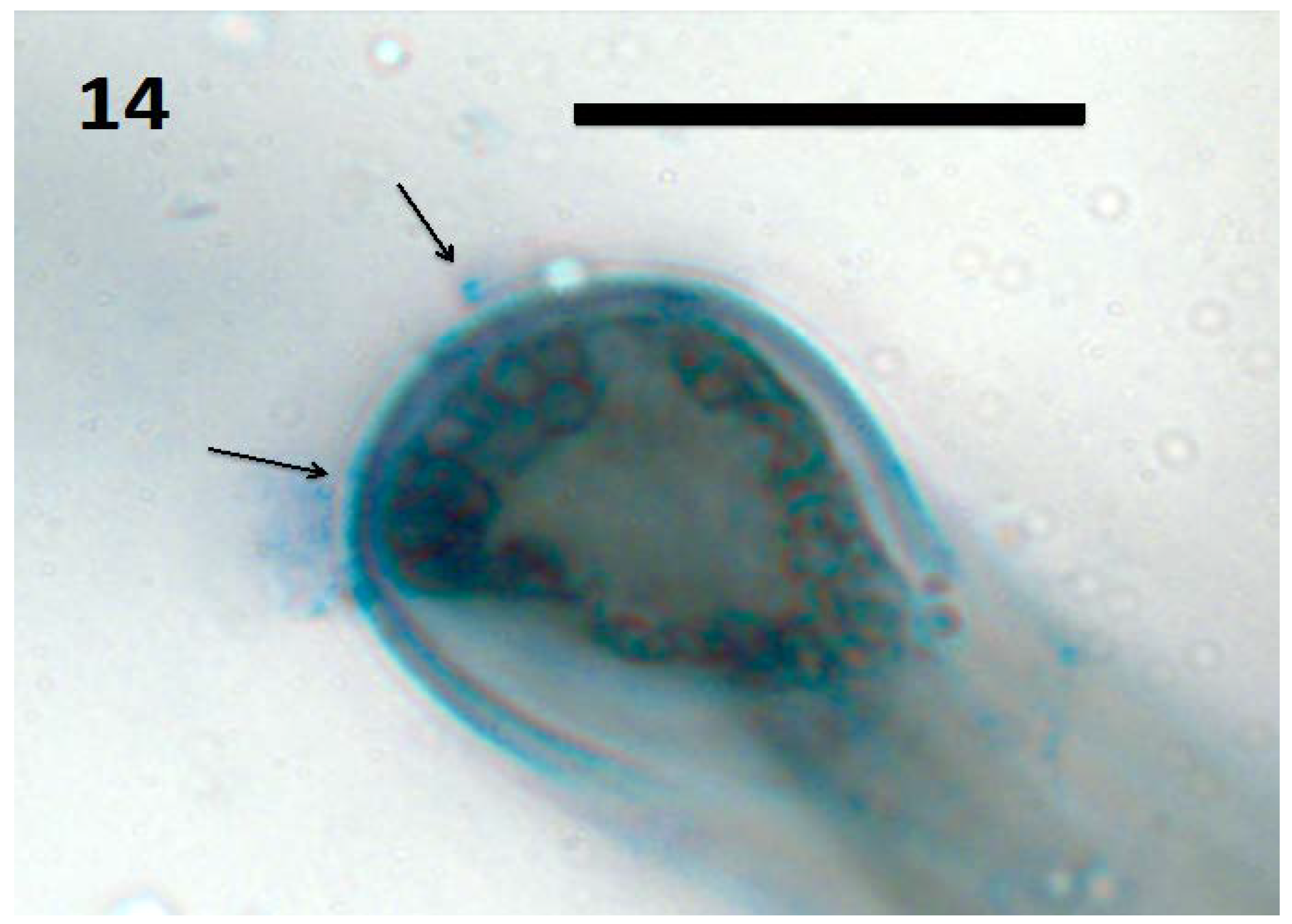 Microorganisms 06 00095 g014