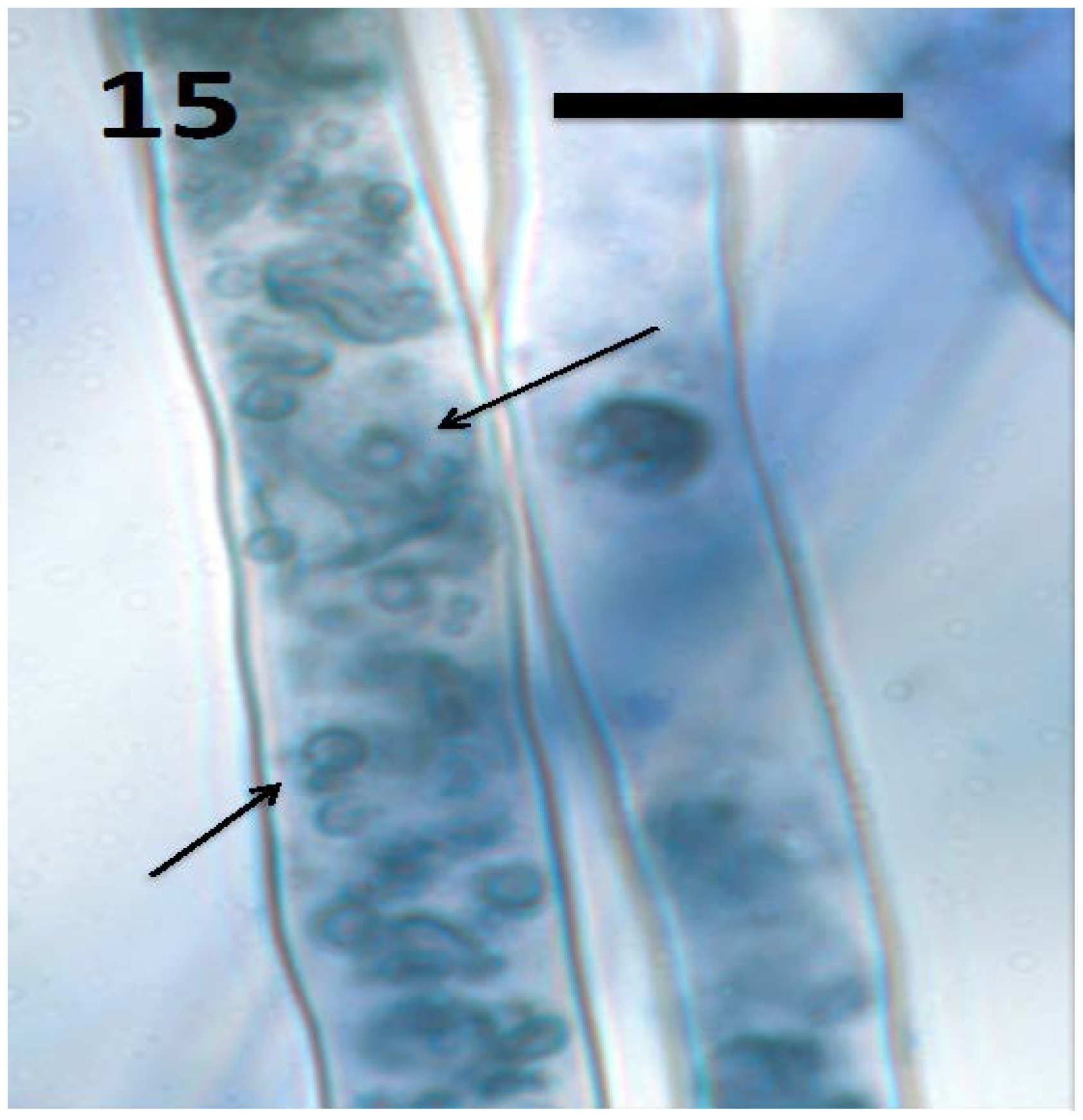 Microorganisms 06 00095 g015