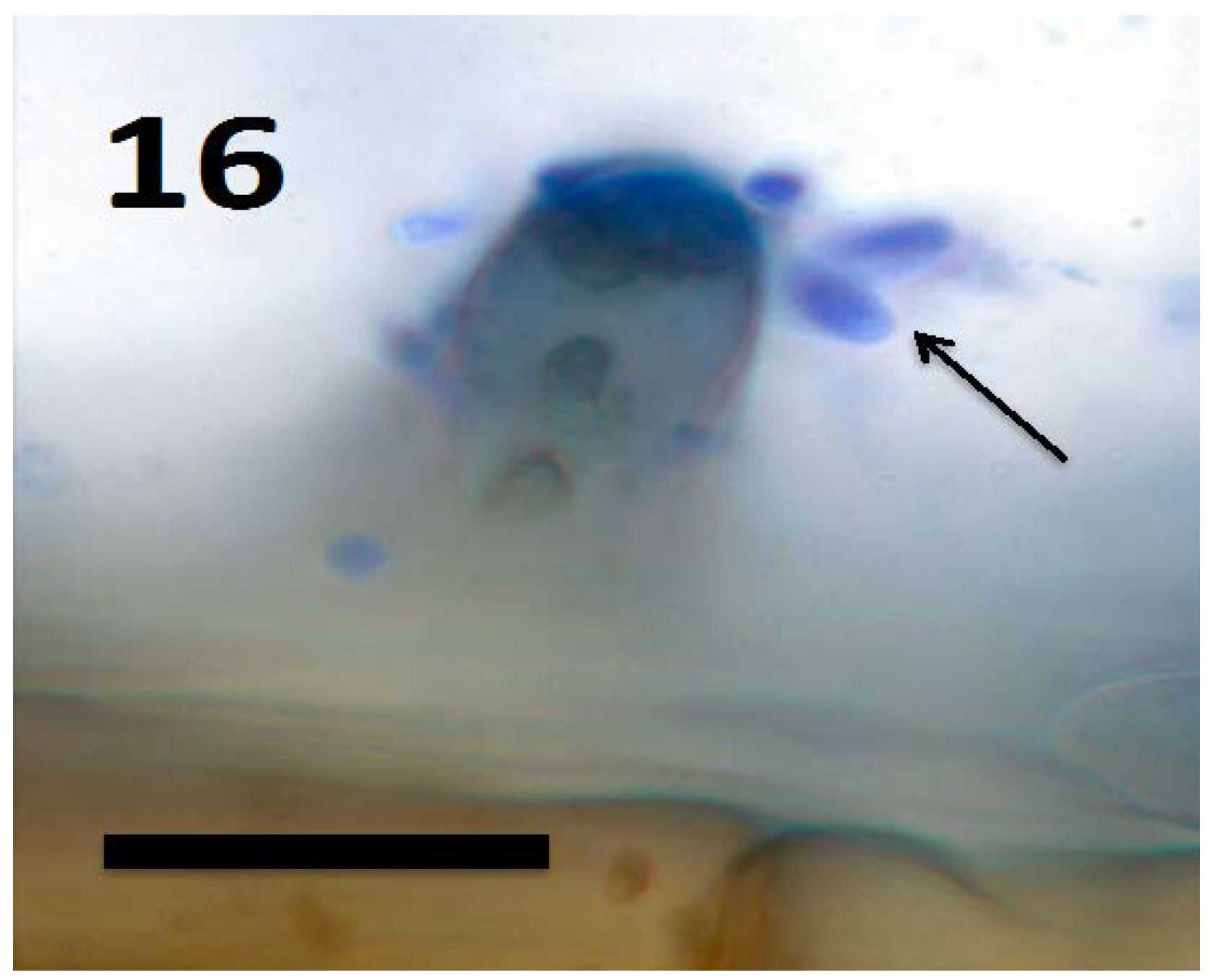 Microorganisms 06 00095 g016