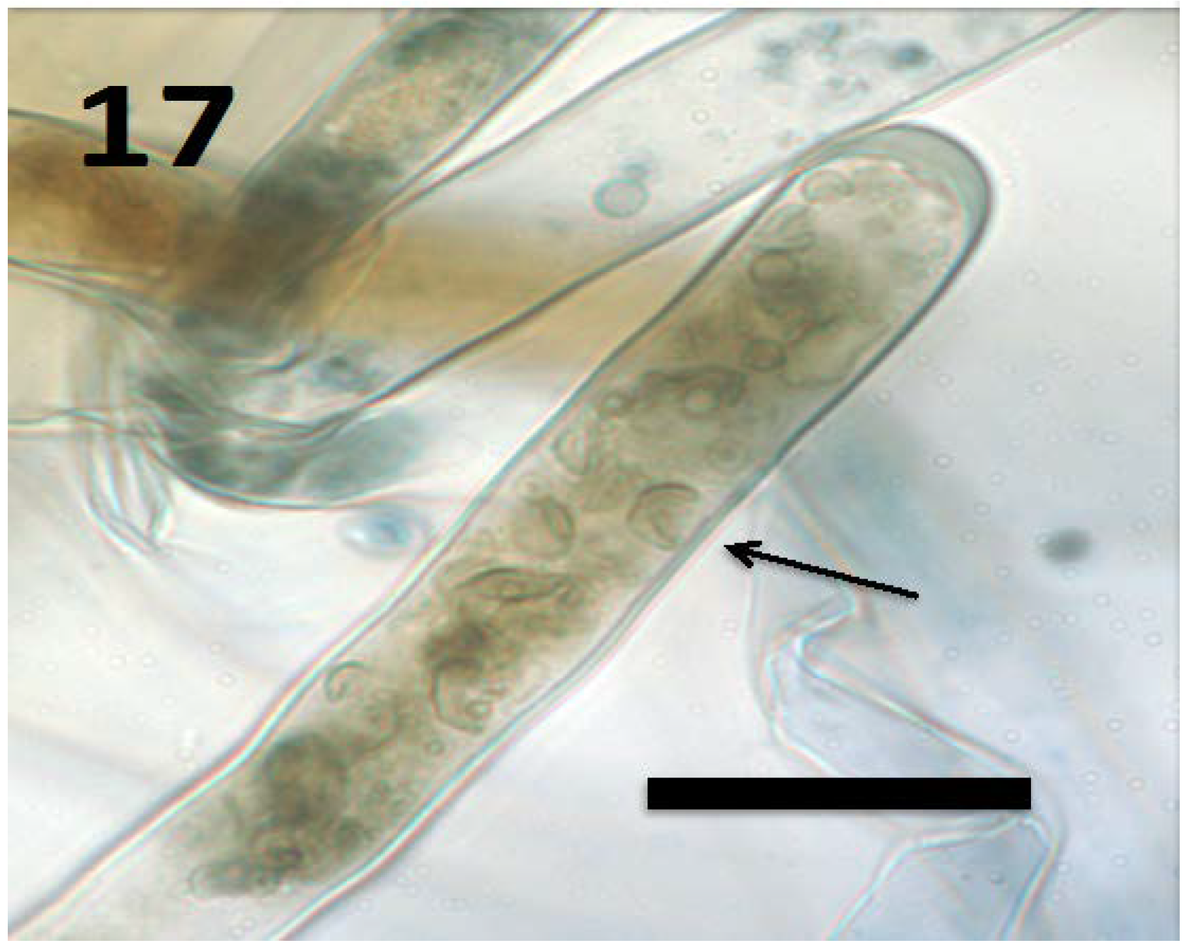 Microorganisms 06 00095 g017