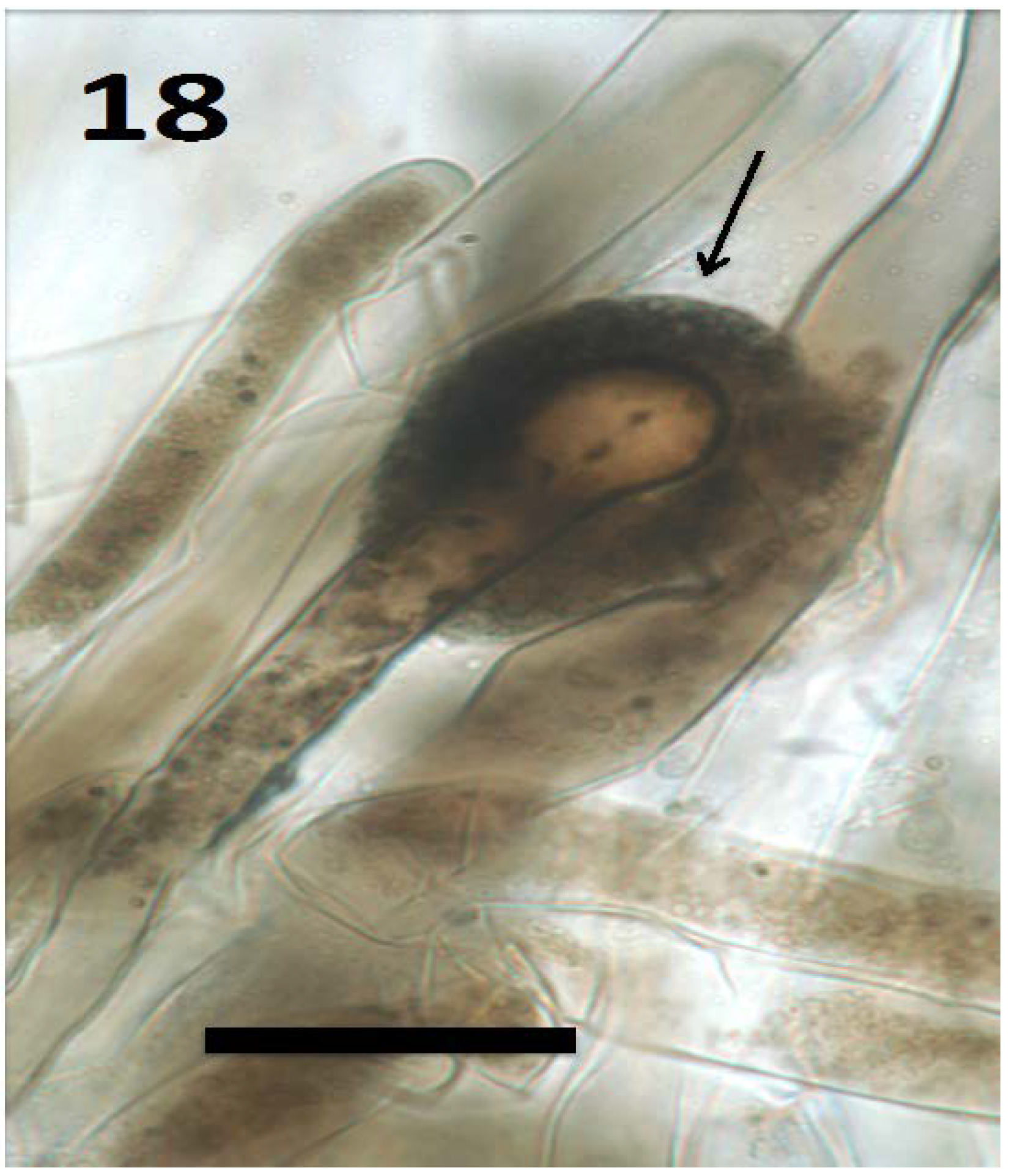 Microorganisms 06 00095 g018