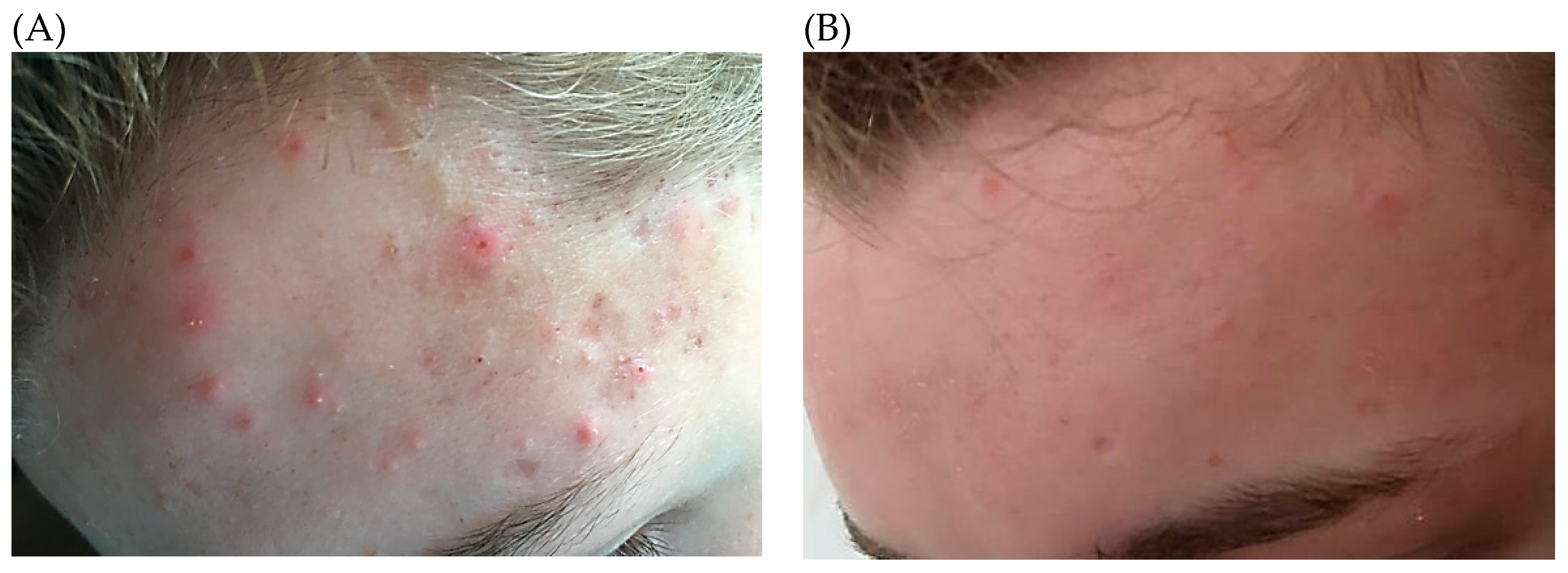 Microorganisms 07 00128 g003 Microorganisms 07 00128 g003