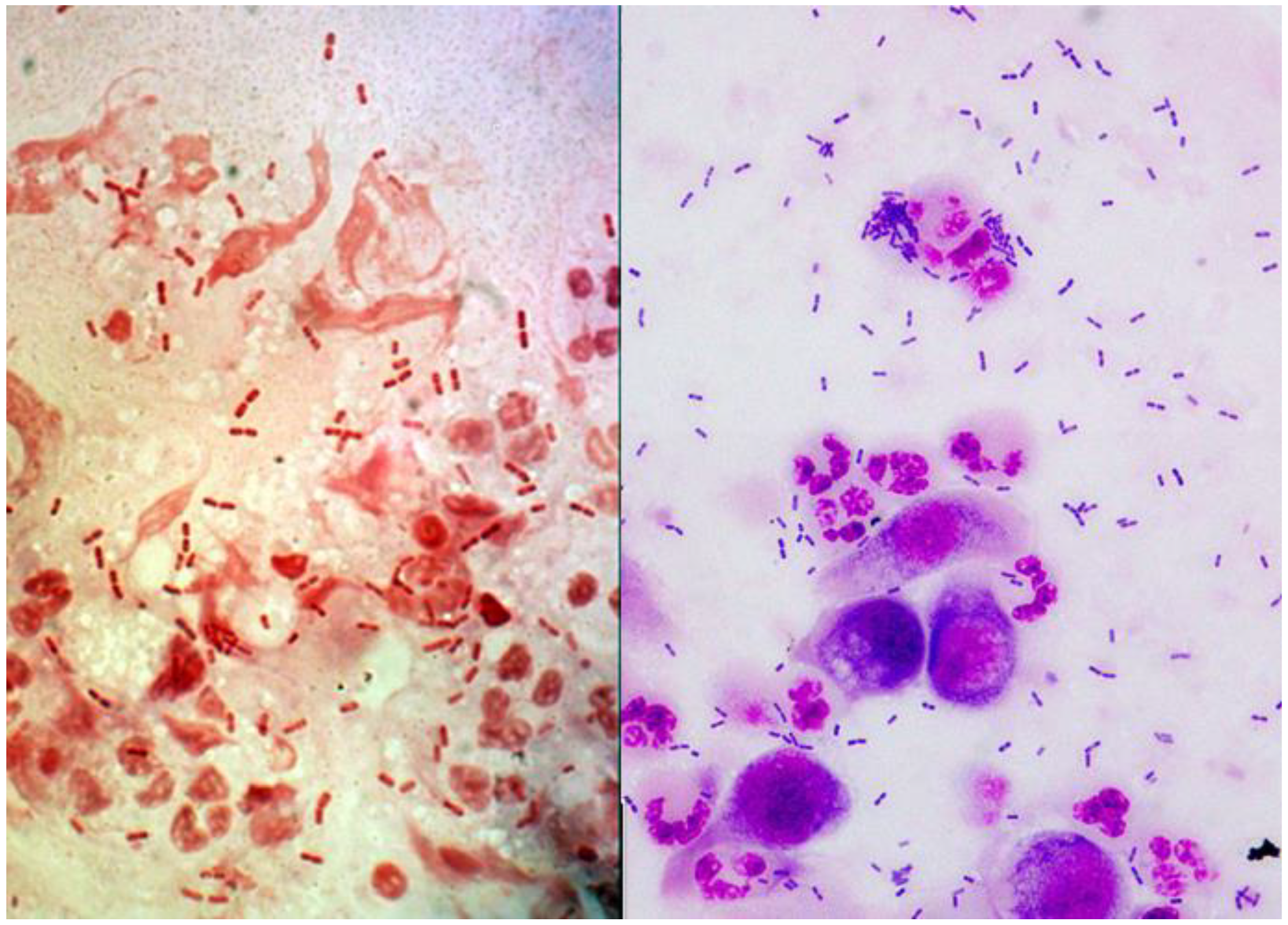Microorganisms 07 00163 g001