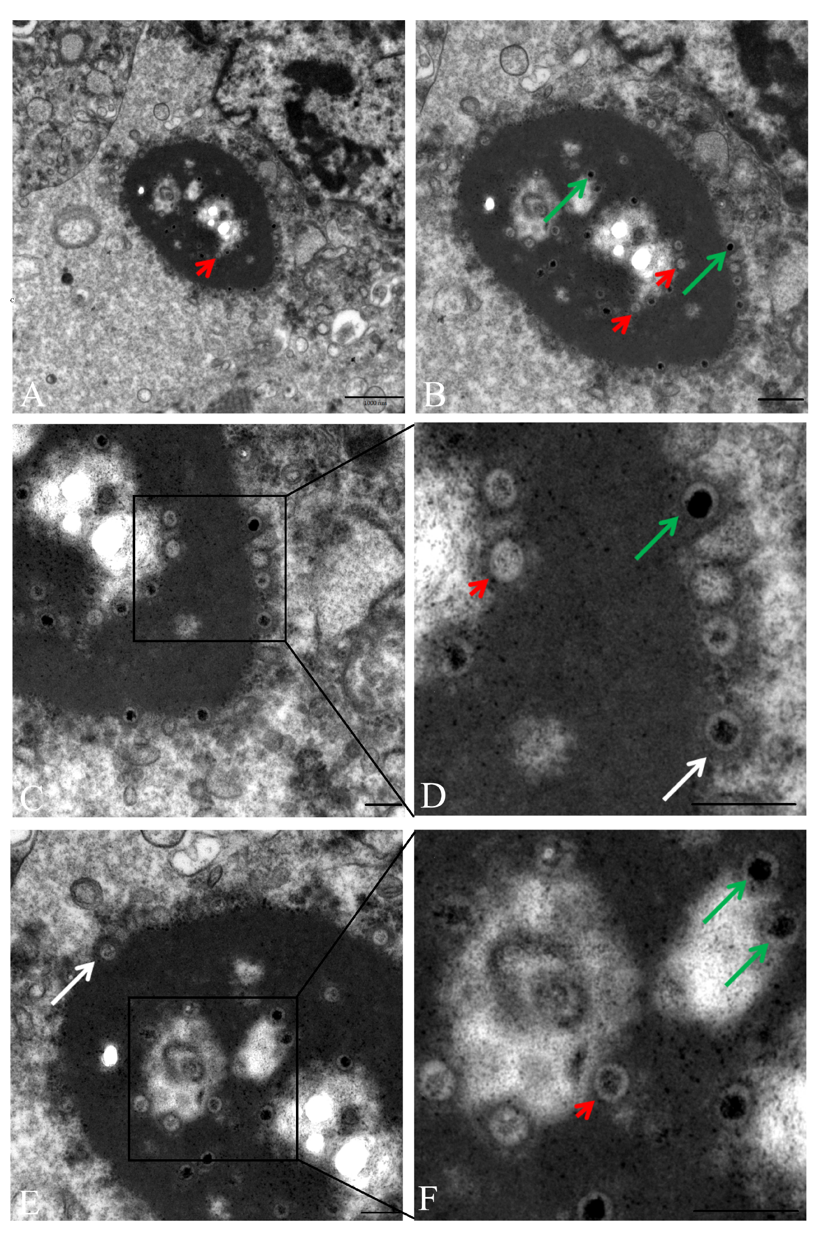Microorganisms 07 00396 g005