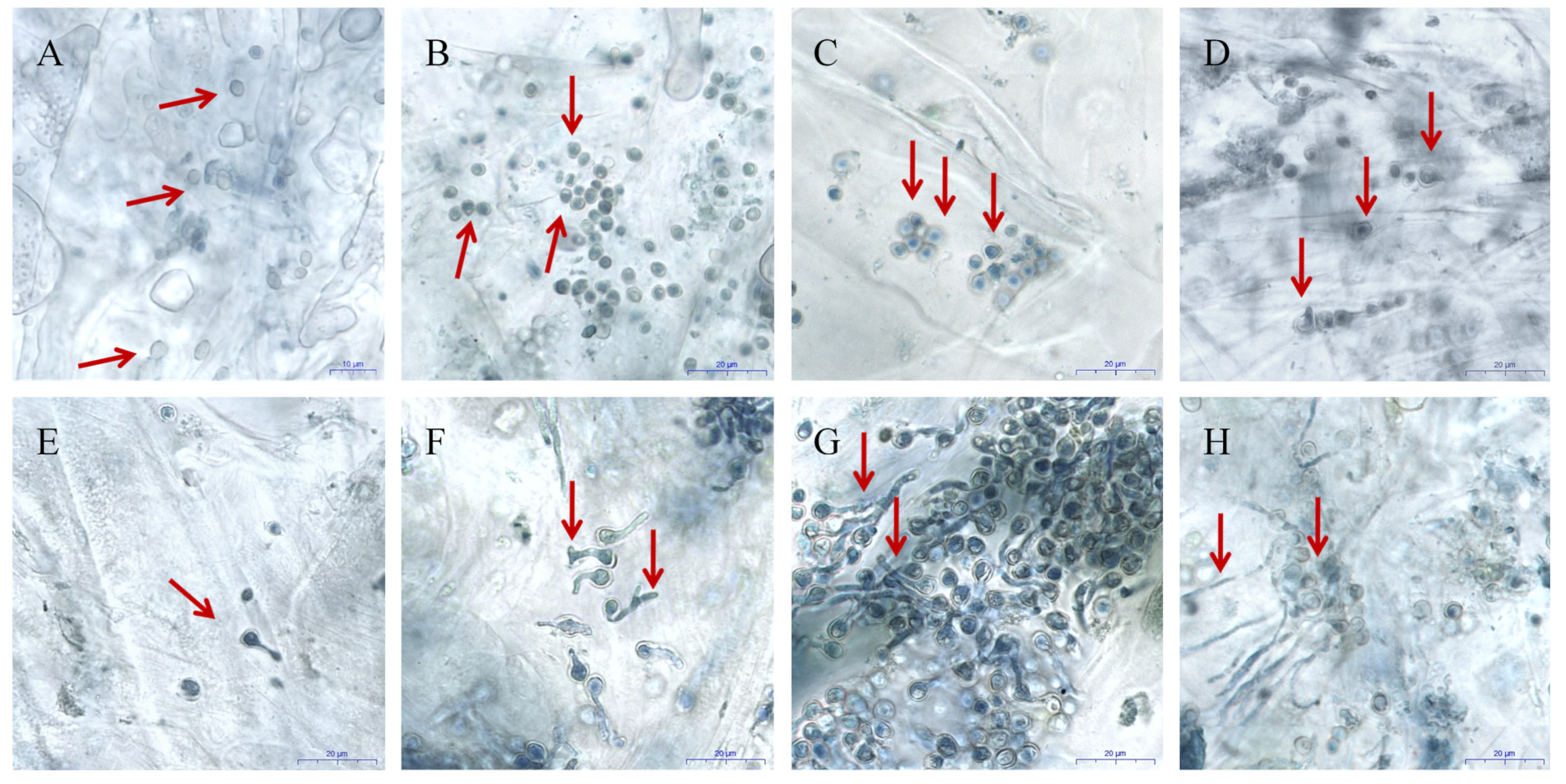 Microorganisms 07 00495 g001 Microorganisms 07 00495 g001