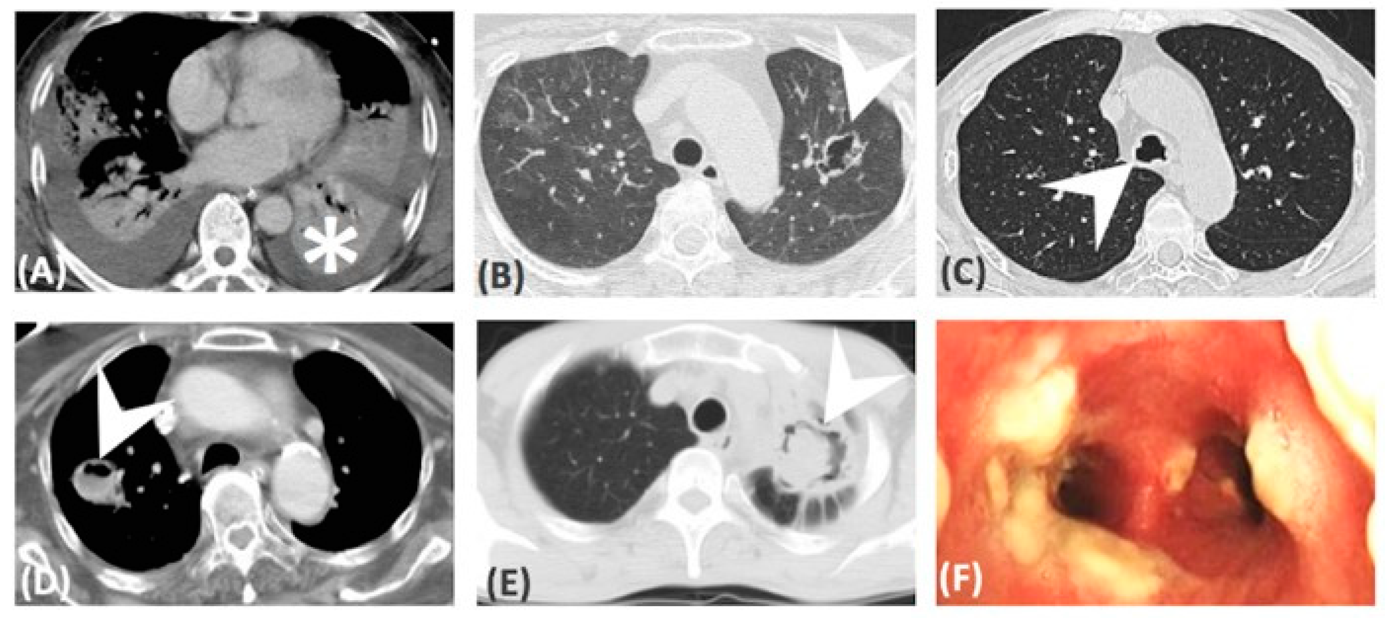 Microorganisms 07 00531 g003 Microorganisms 07 00531 g003