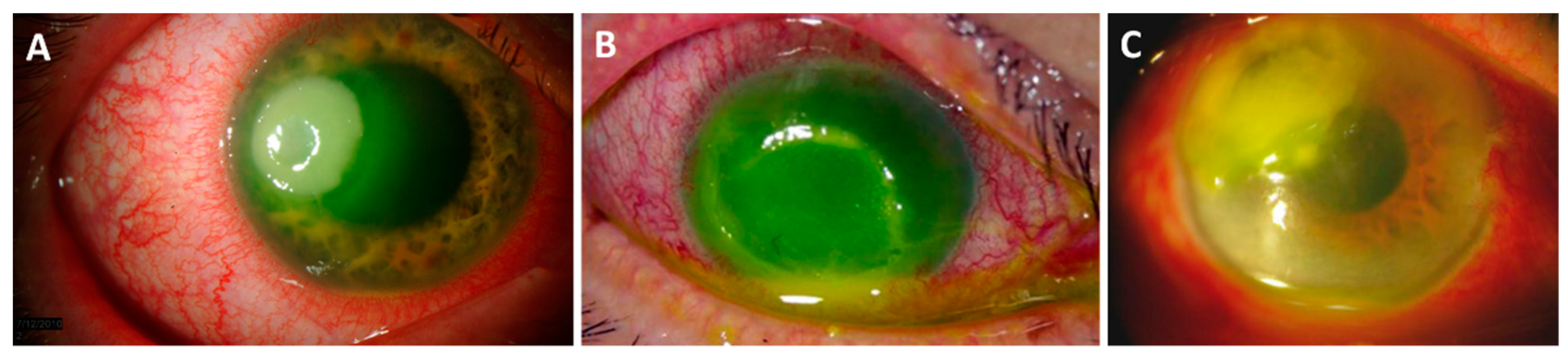 Microorganisms 07 00537 g004