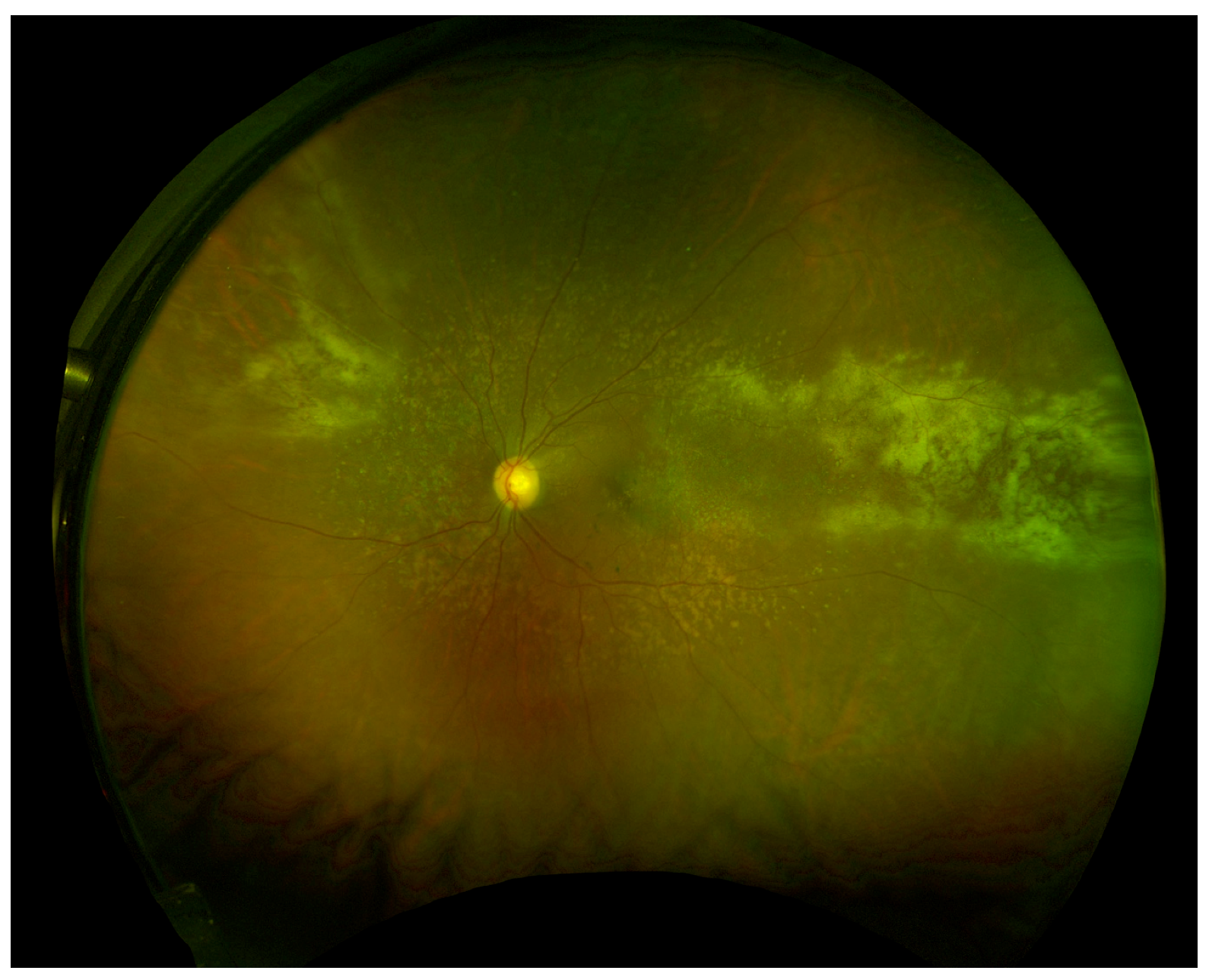 Microorganisms 08 00055 g001