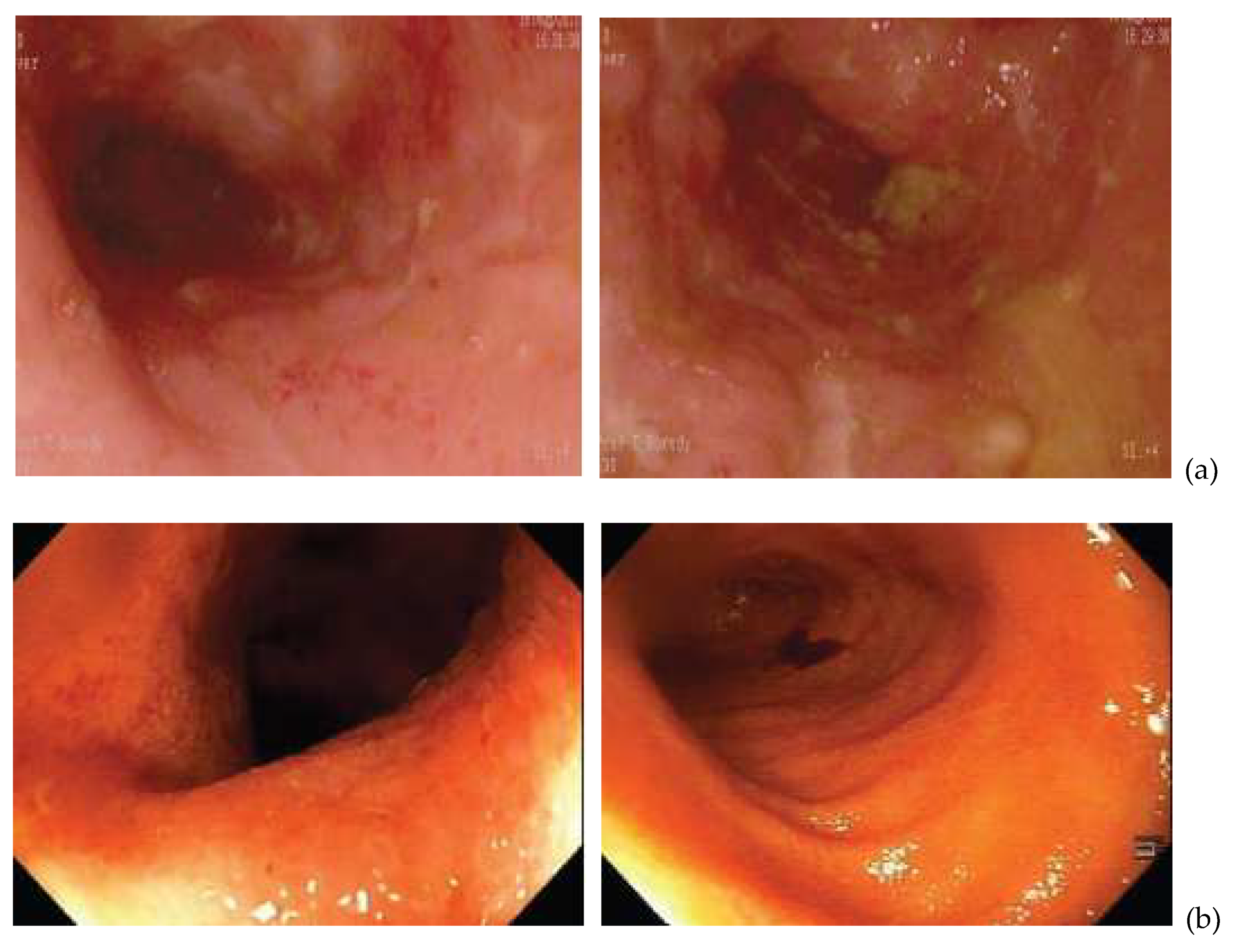 Microorganisms 08 00371 g001