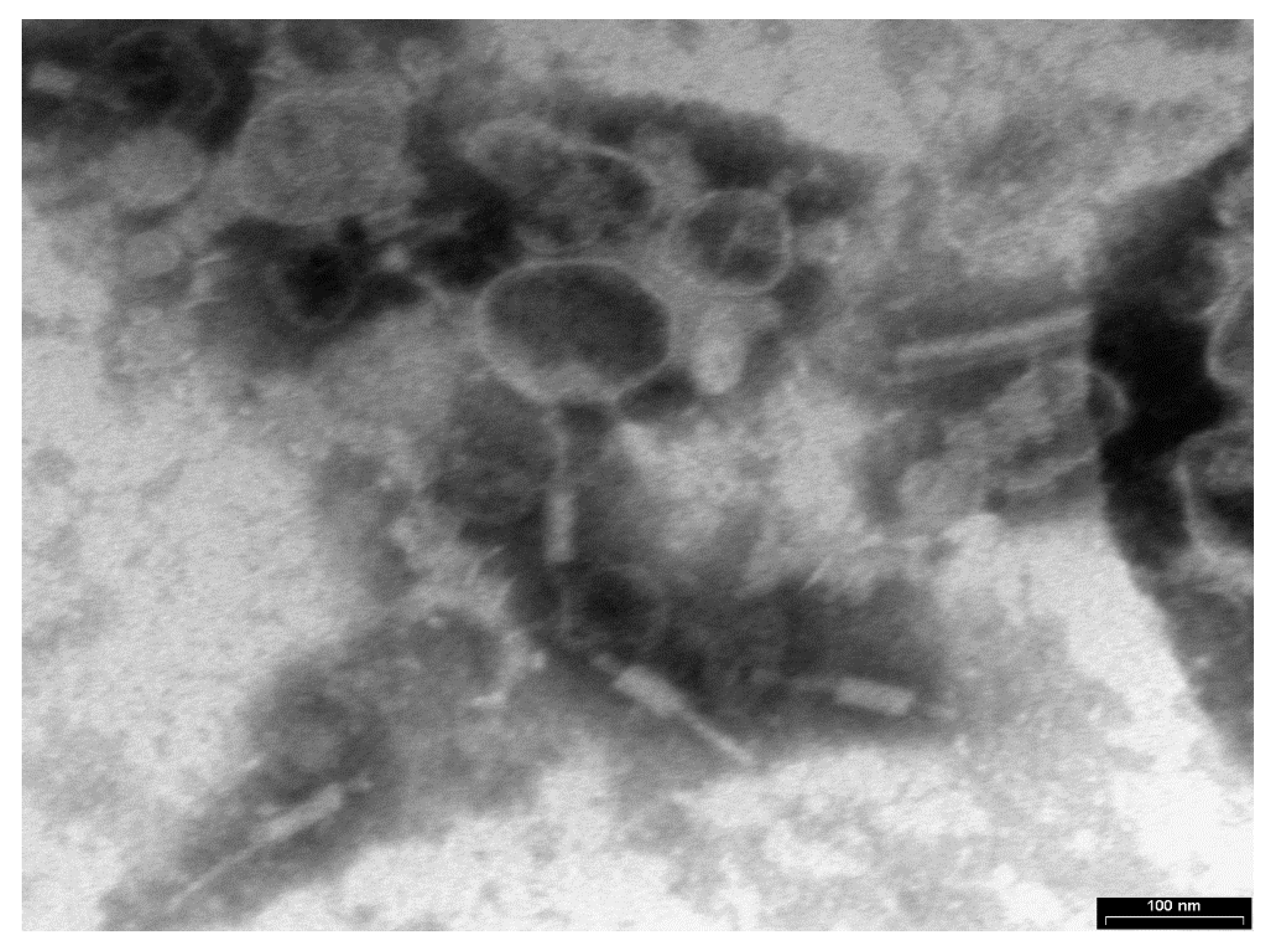 Microorganisms 08 00480 g001