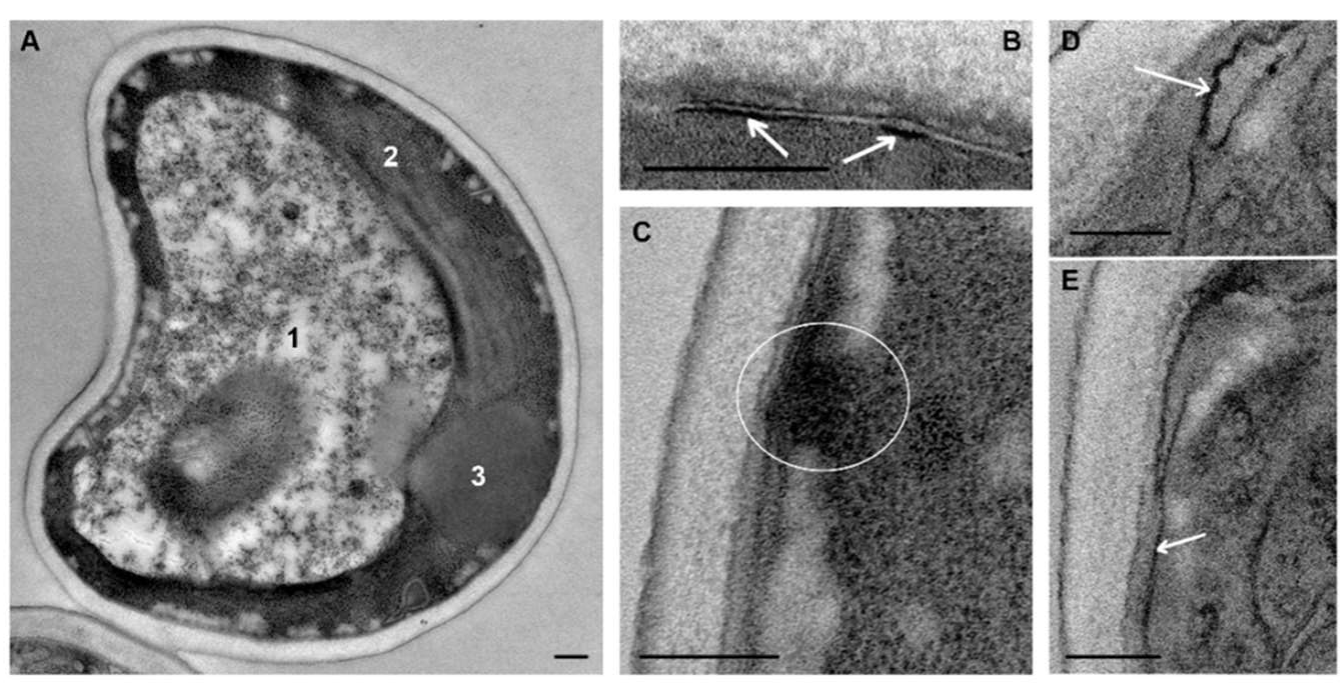 Microorganisms 08 00582 g005 Microorganisms 08 00582 g005