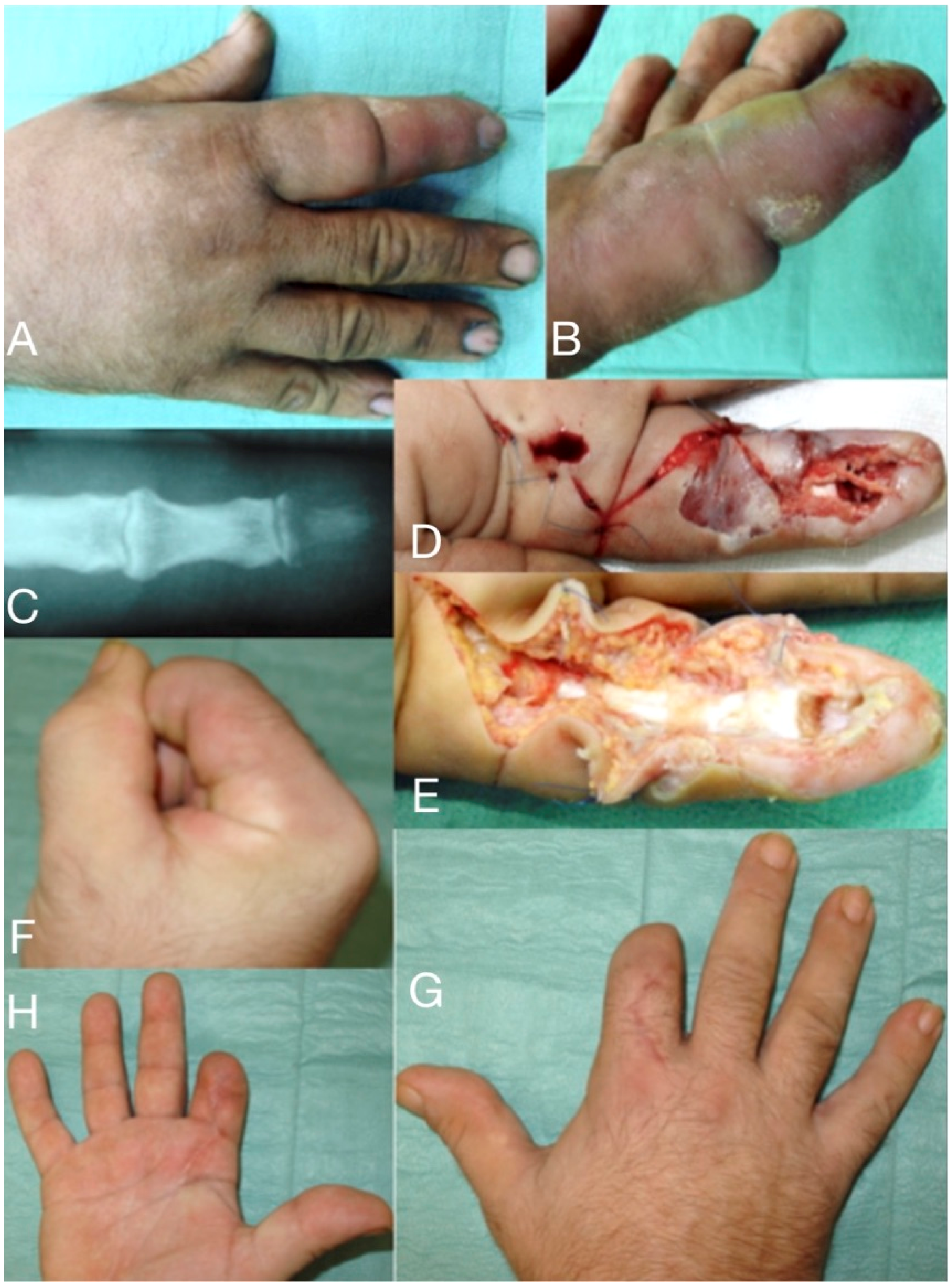 Microorganisms 08 00838 g001 Microorganisms 08 00838 g001
