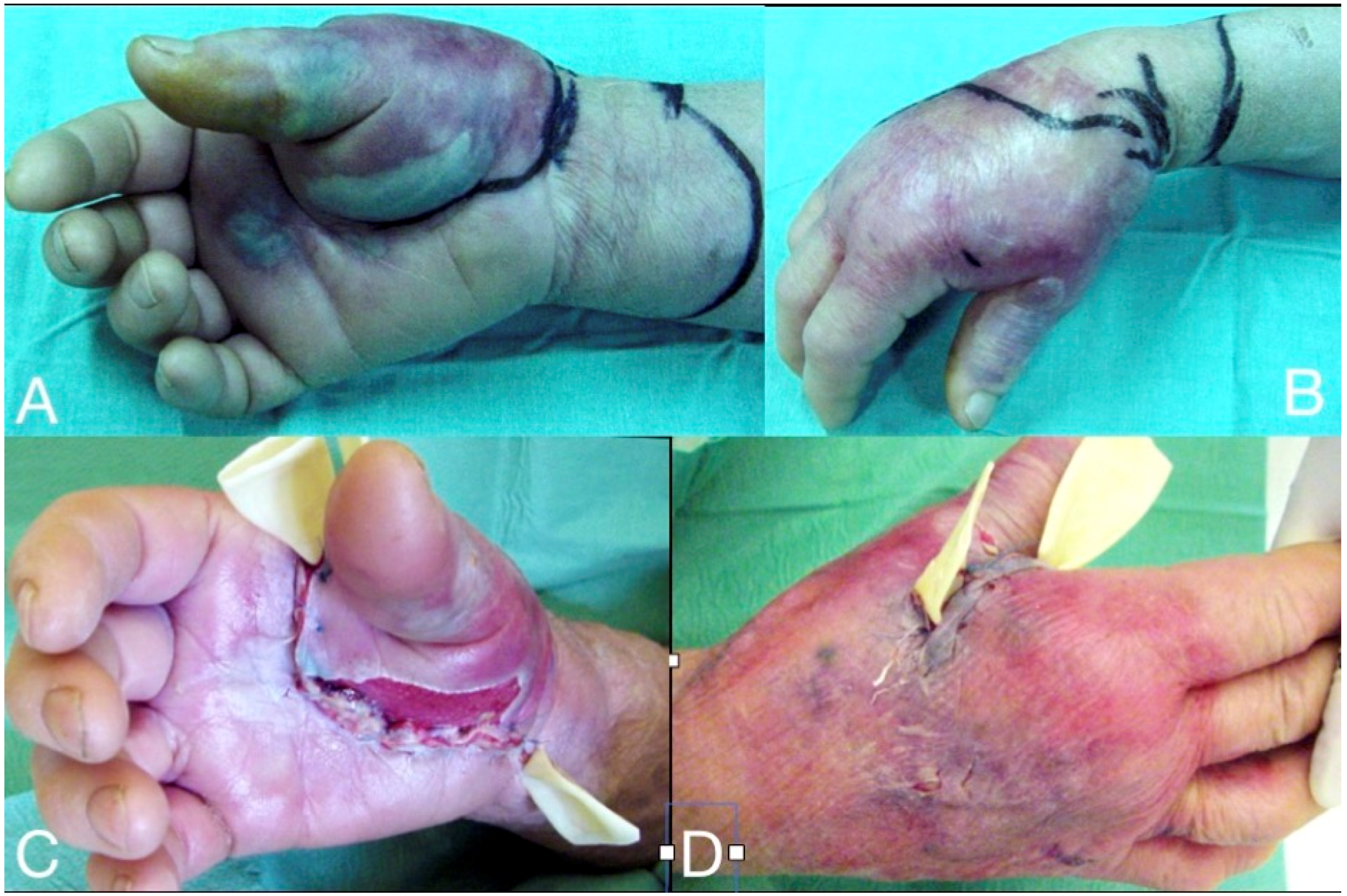 Microorganisms 08 00838 g002 Microorganisms 08 00838 g002