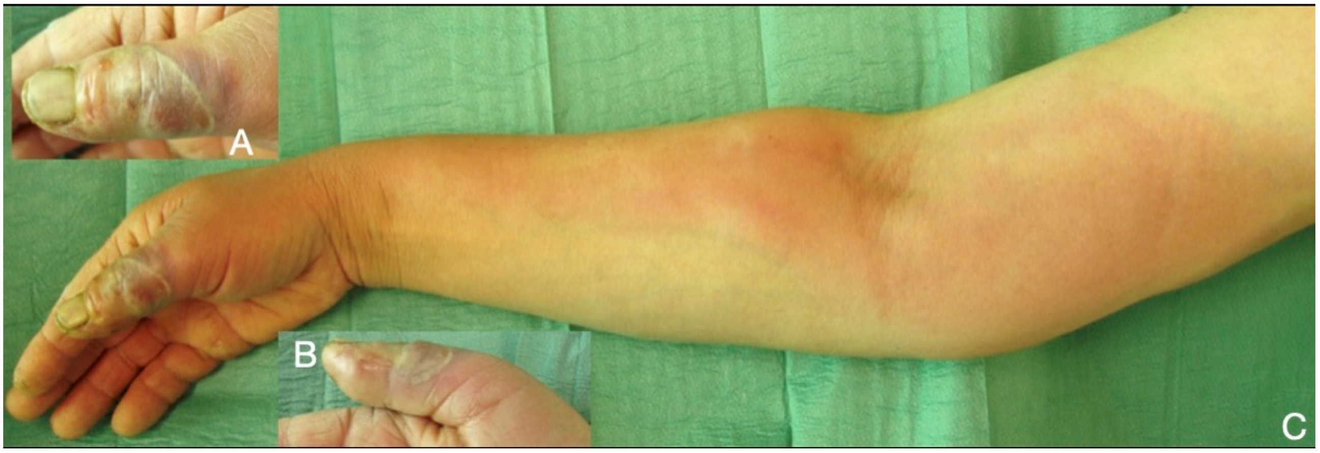 Microorganisms 08 00838 g005 Microorganisms 08 00838 g005