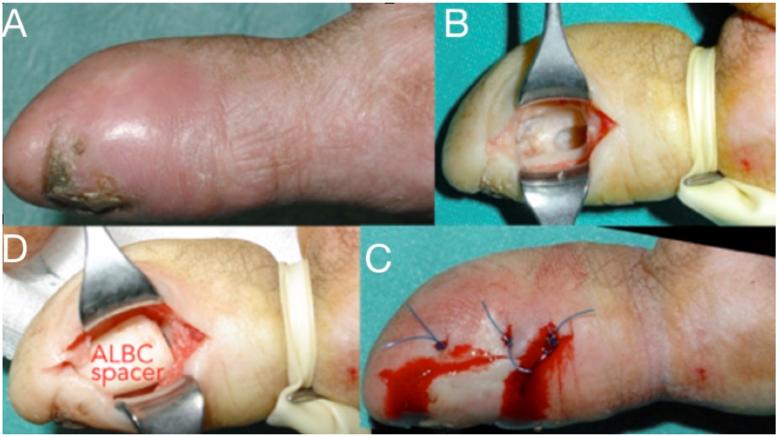 Microorganisms 08 00838 g008 Microorganisms 08 00838 g008