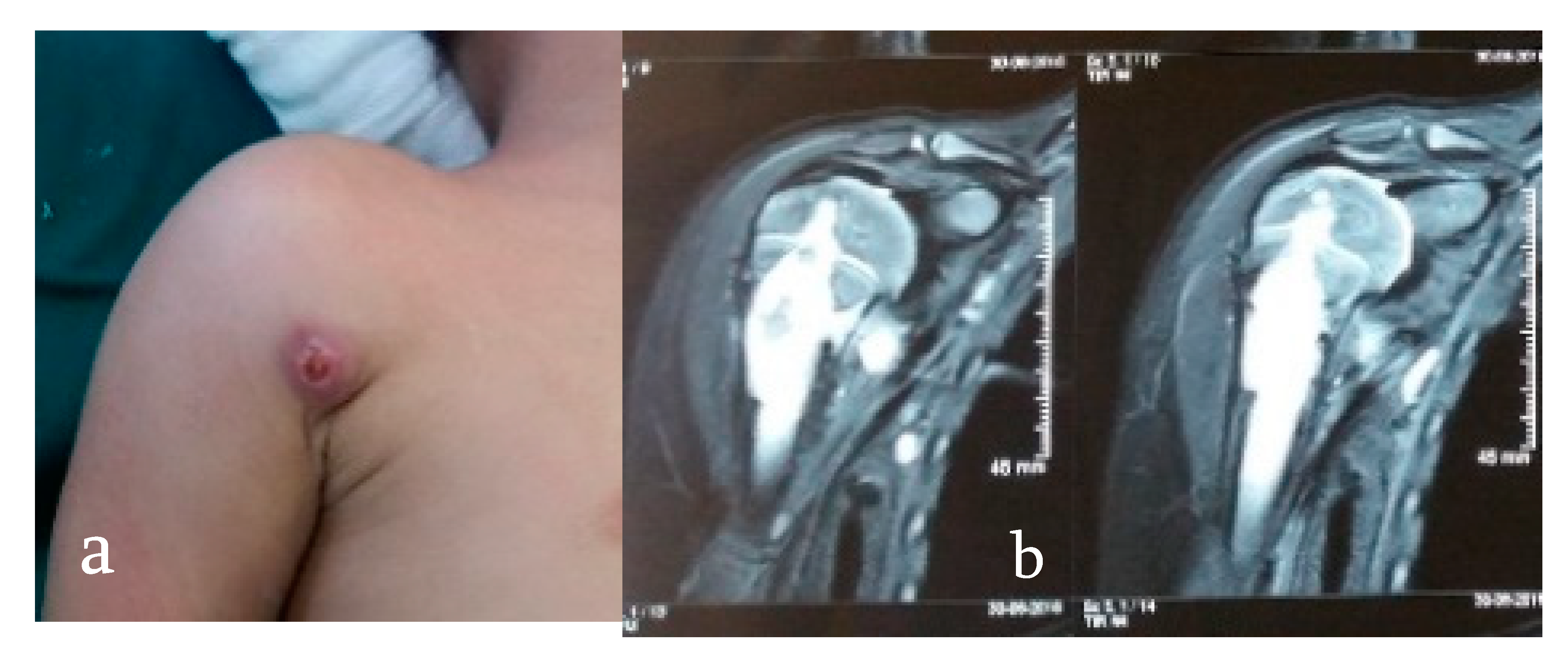 Microorganisms 08 01312 g003