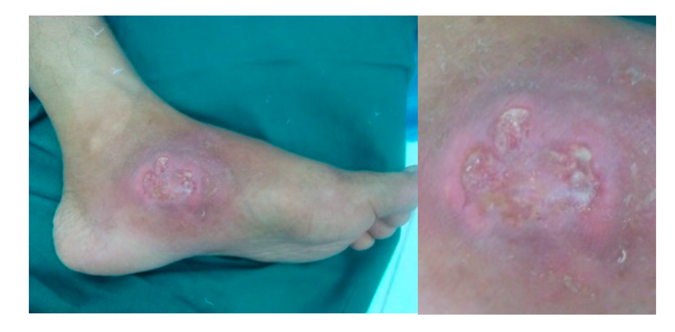 Microorganisms 08 01312 g004