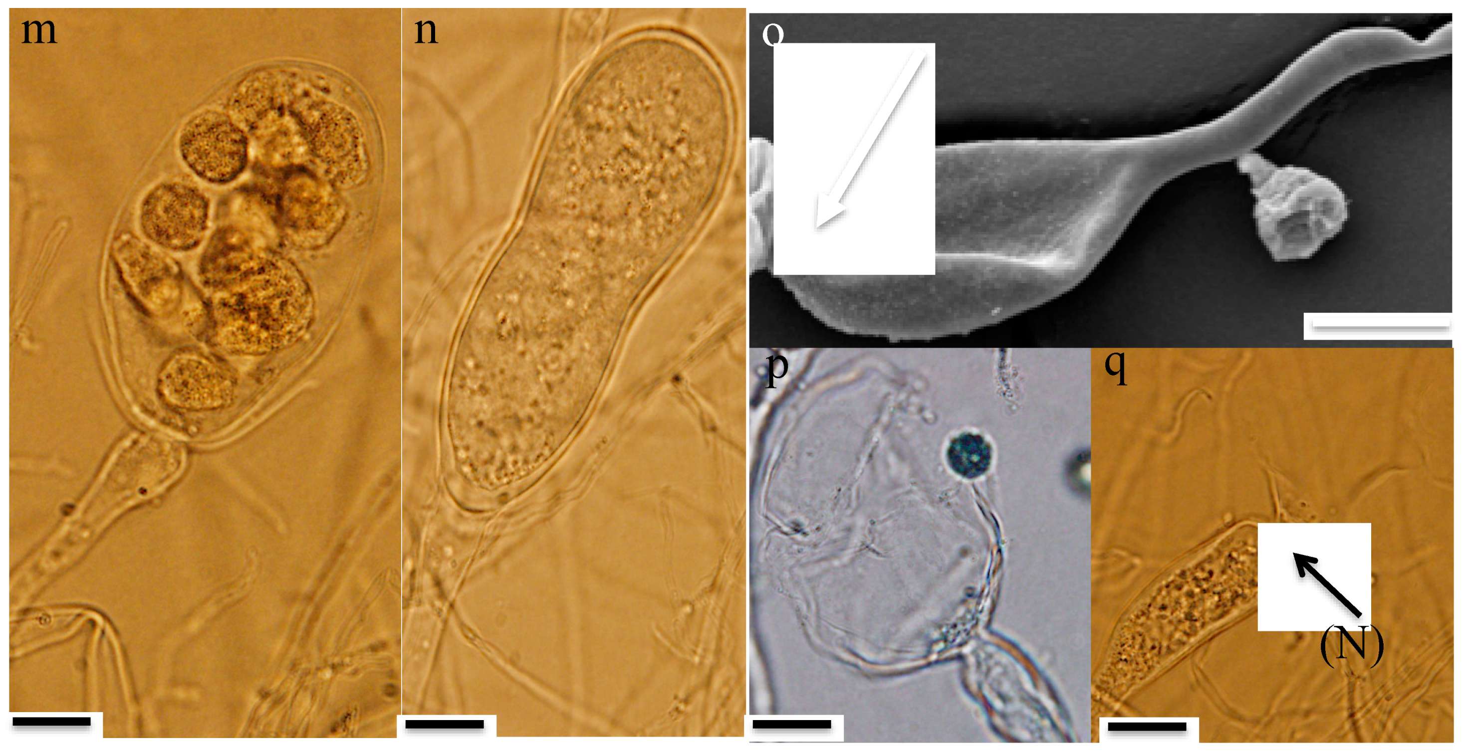 Microorganisms 08 01734 g002b