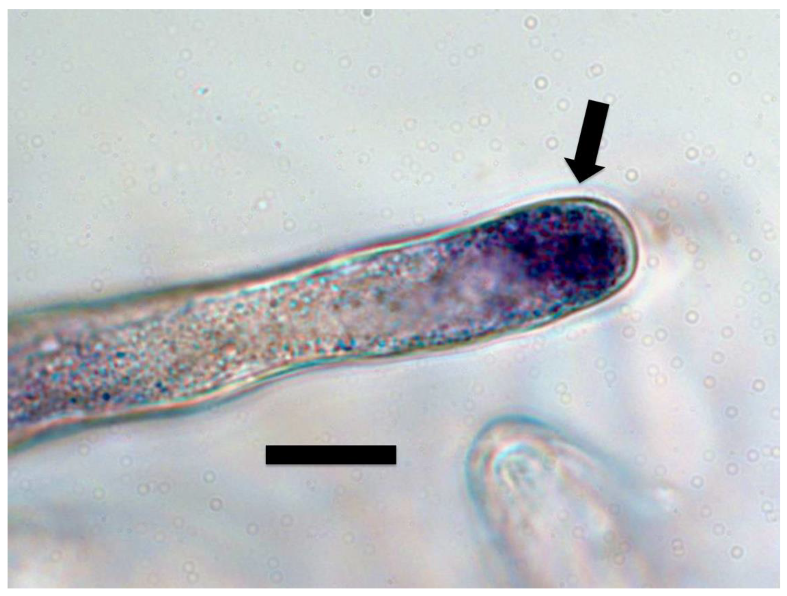 Microorganisms 09 01041 g005