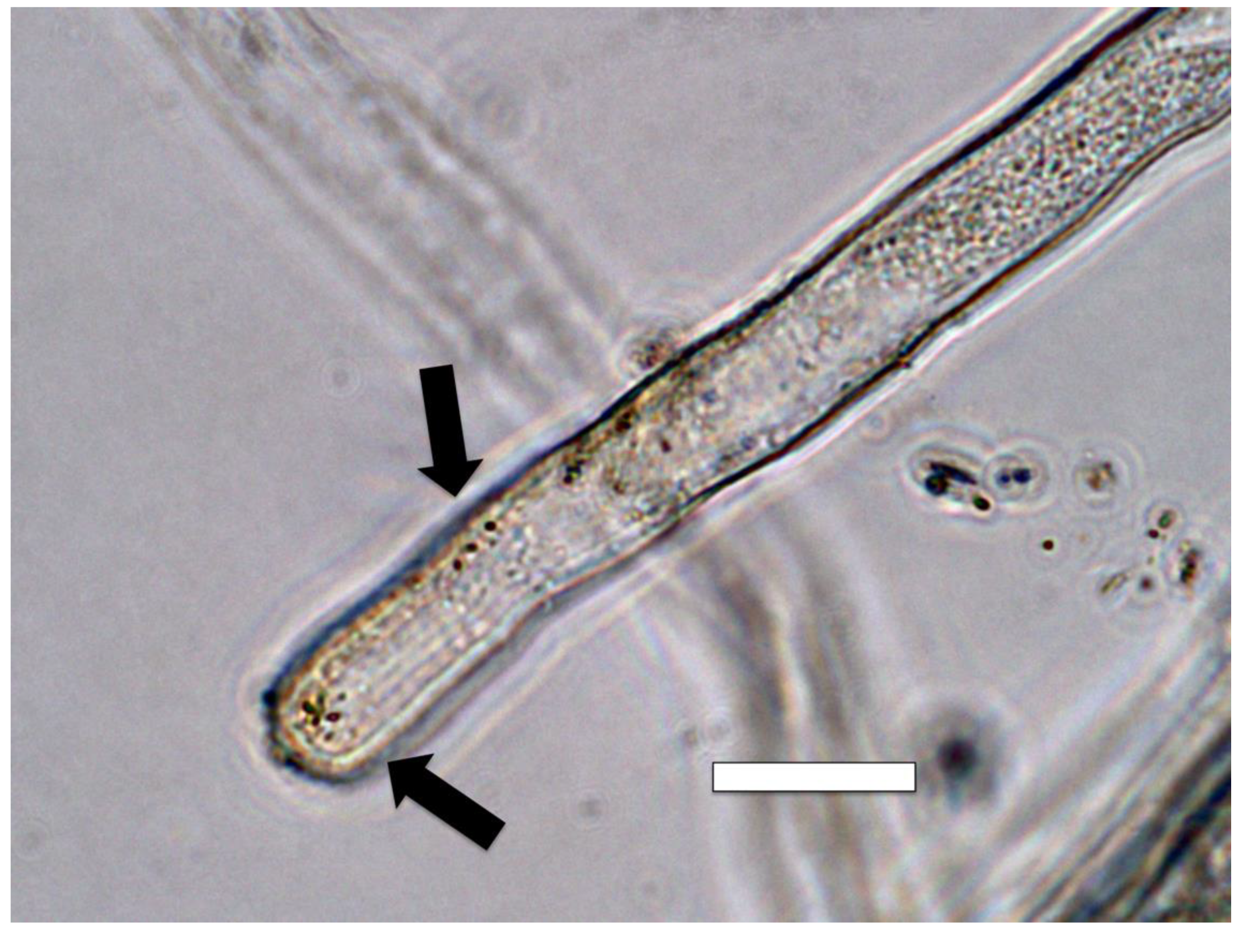 Microorganisms 09 01041 g011