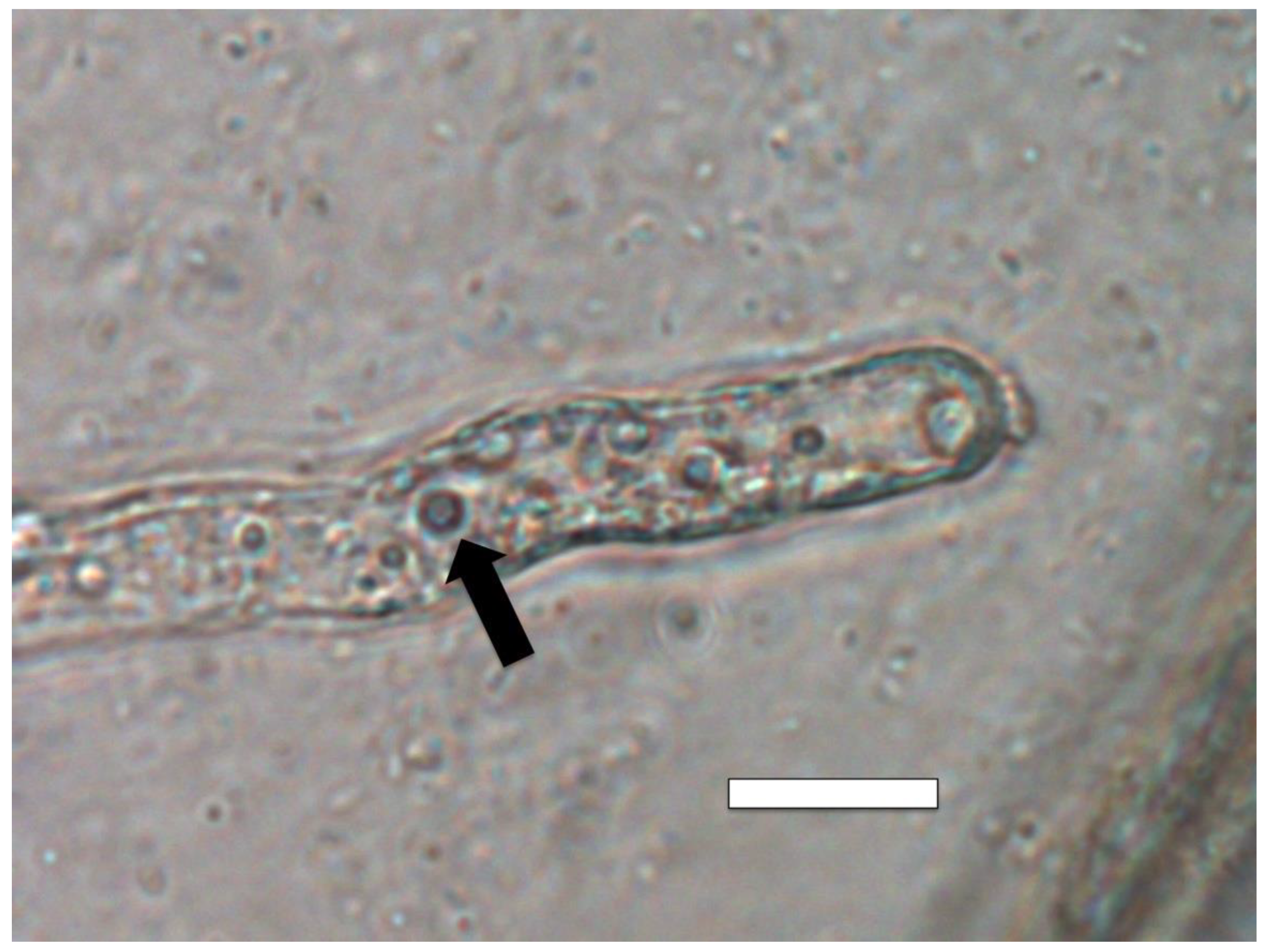 Microorganisms 09 01041 g013