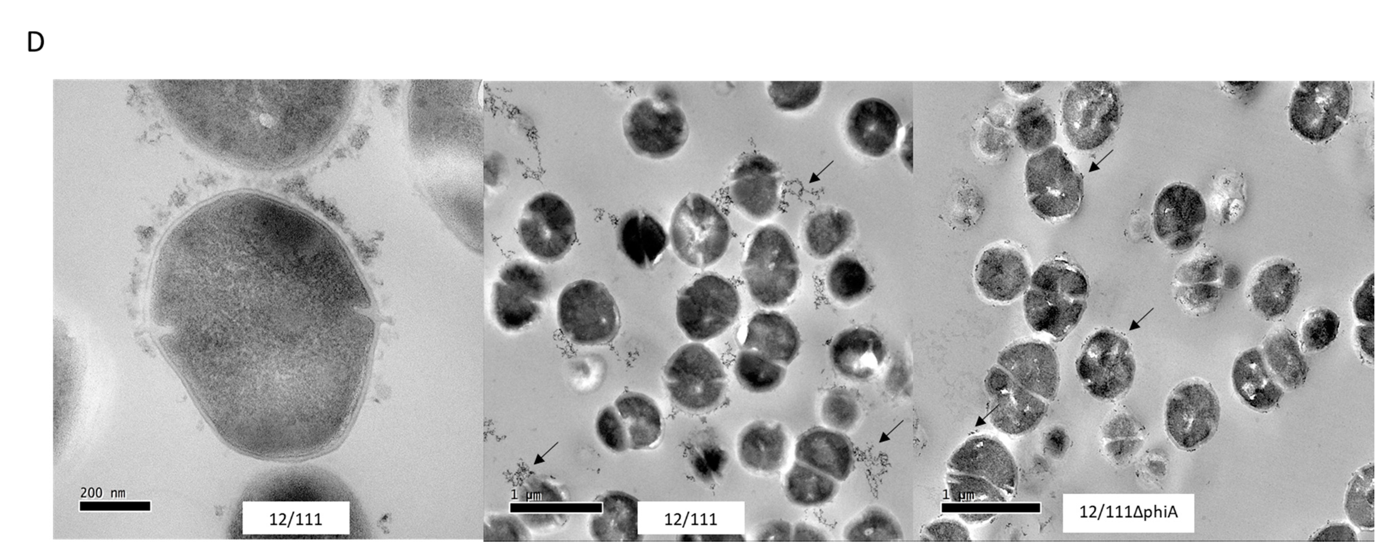 Microorganisms 09 01112 g003c