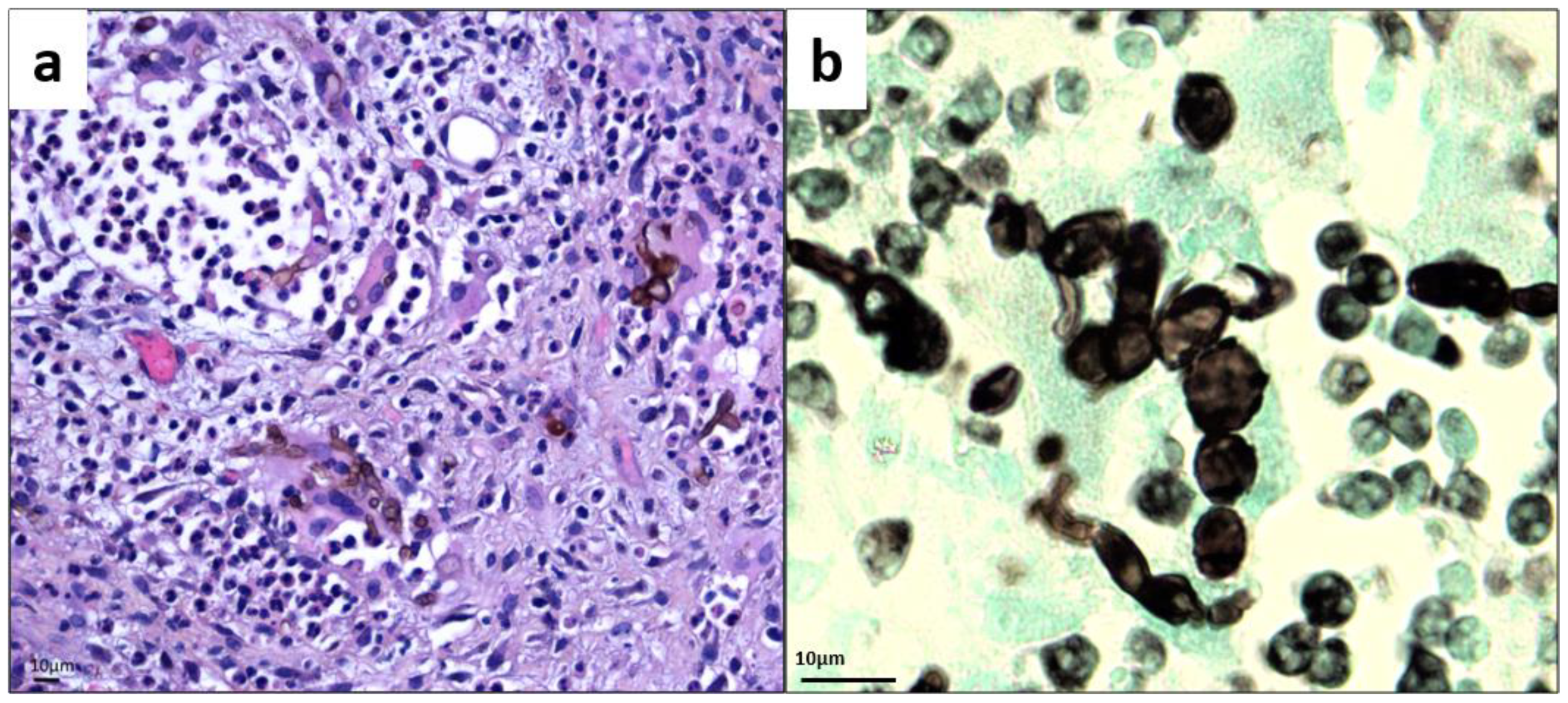 Microorganisms 09 02139 g002