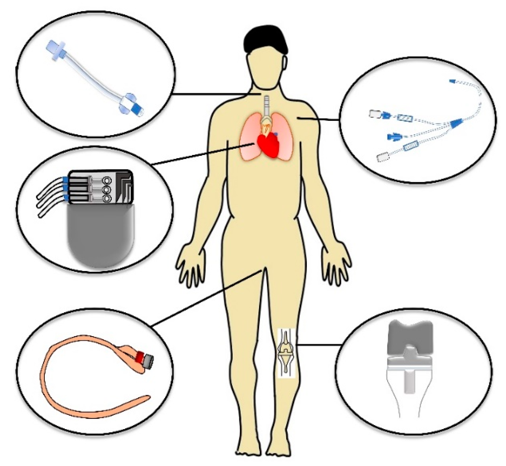 Impact of Healthcare-Associated Infections Connected to Medical Devices ...