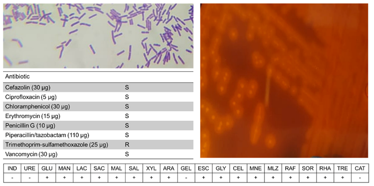 Microorganisms 10 00213 g006