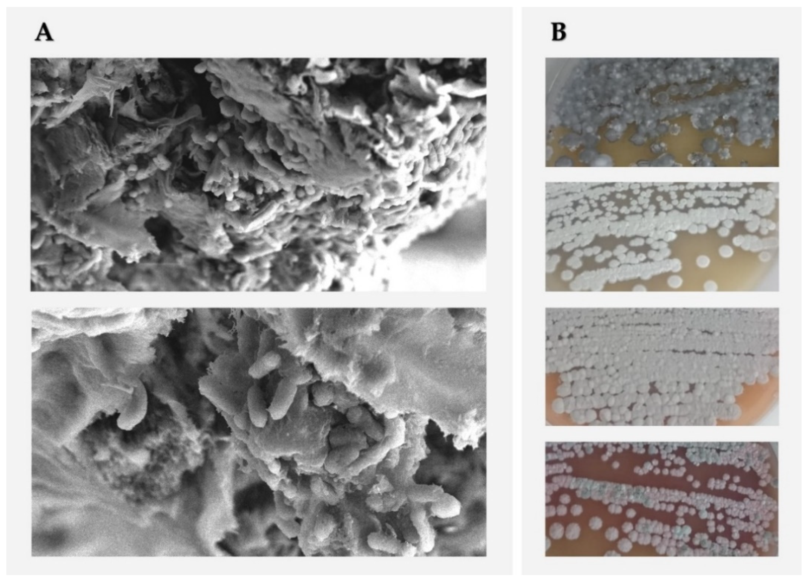 Microorganisms 10 00453 g001