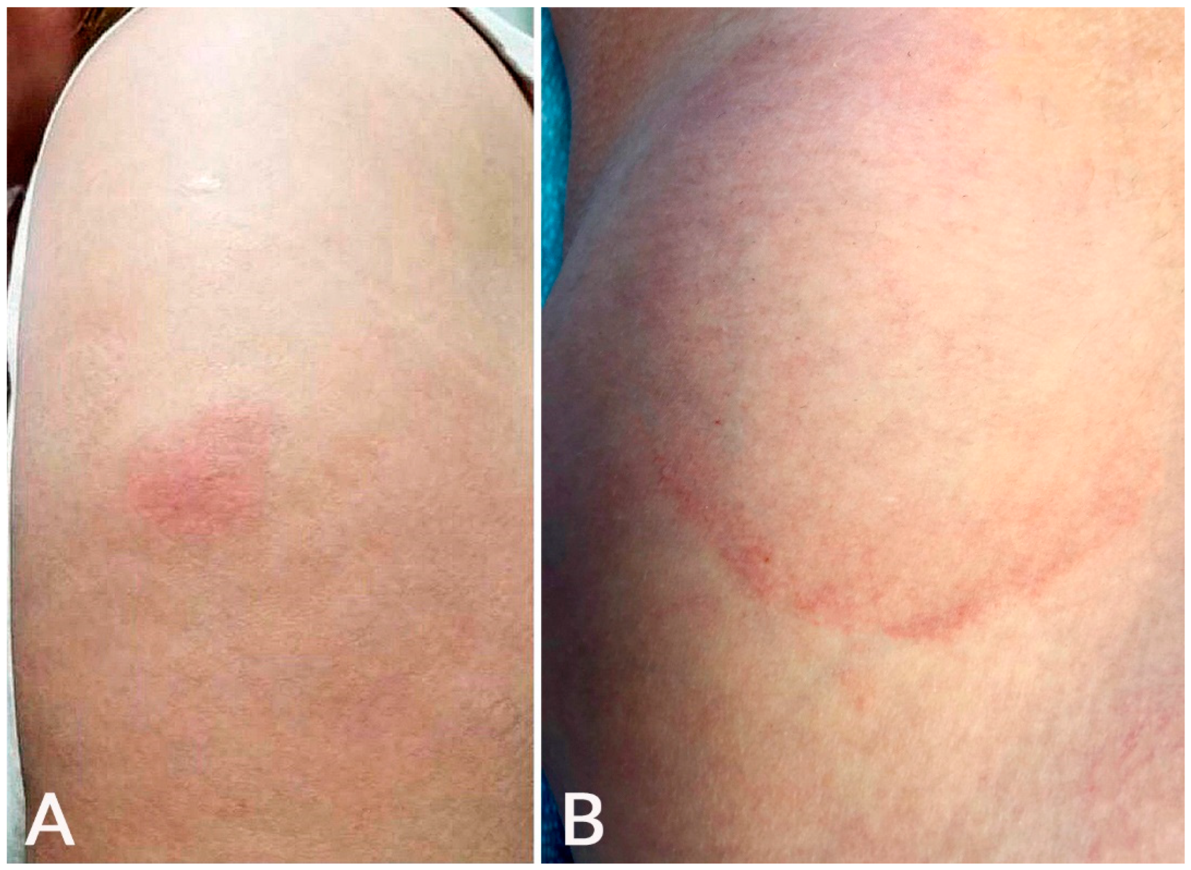 Microorganisms 10 00624 g001