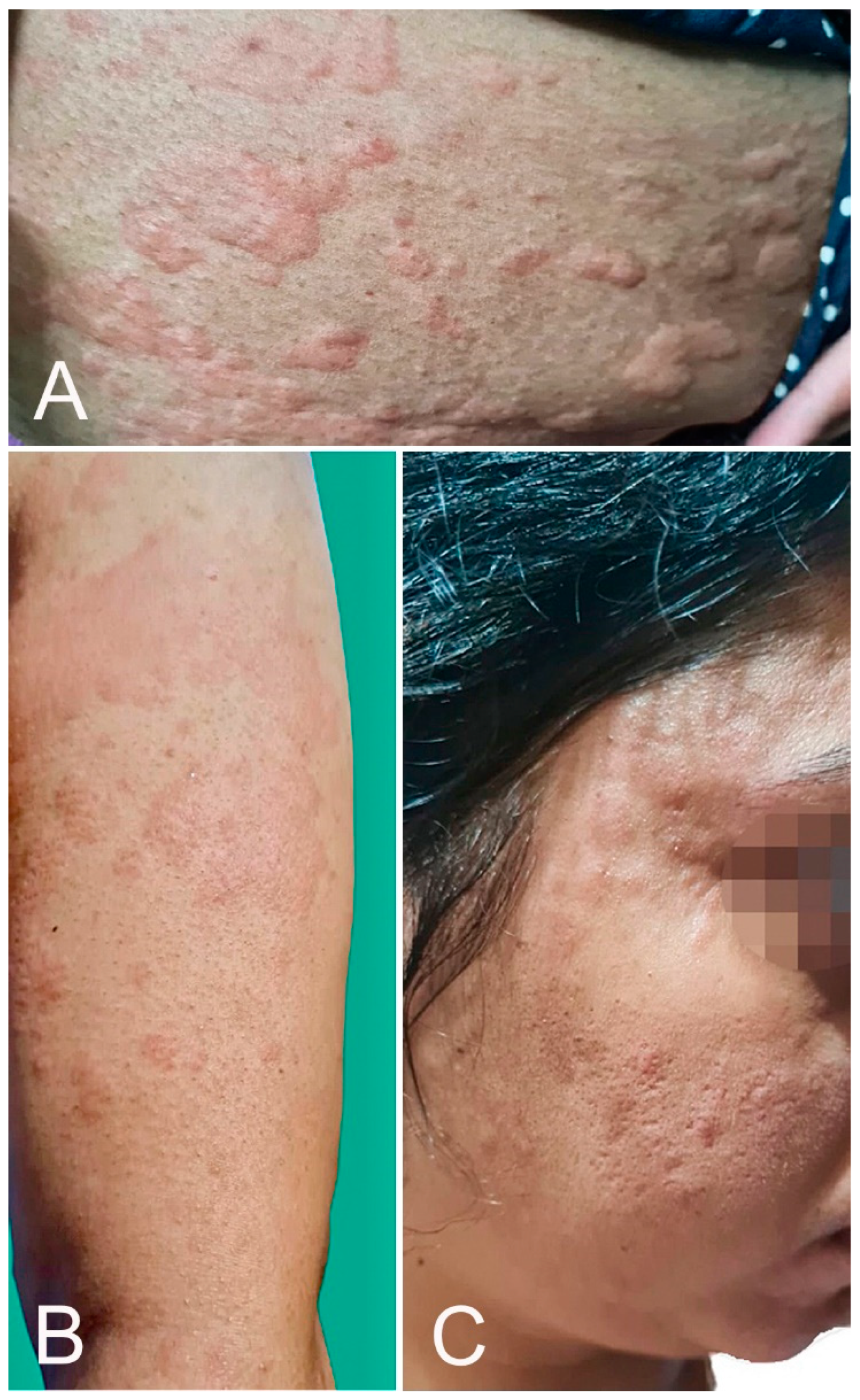 Microorganisms 10 00624 g002