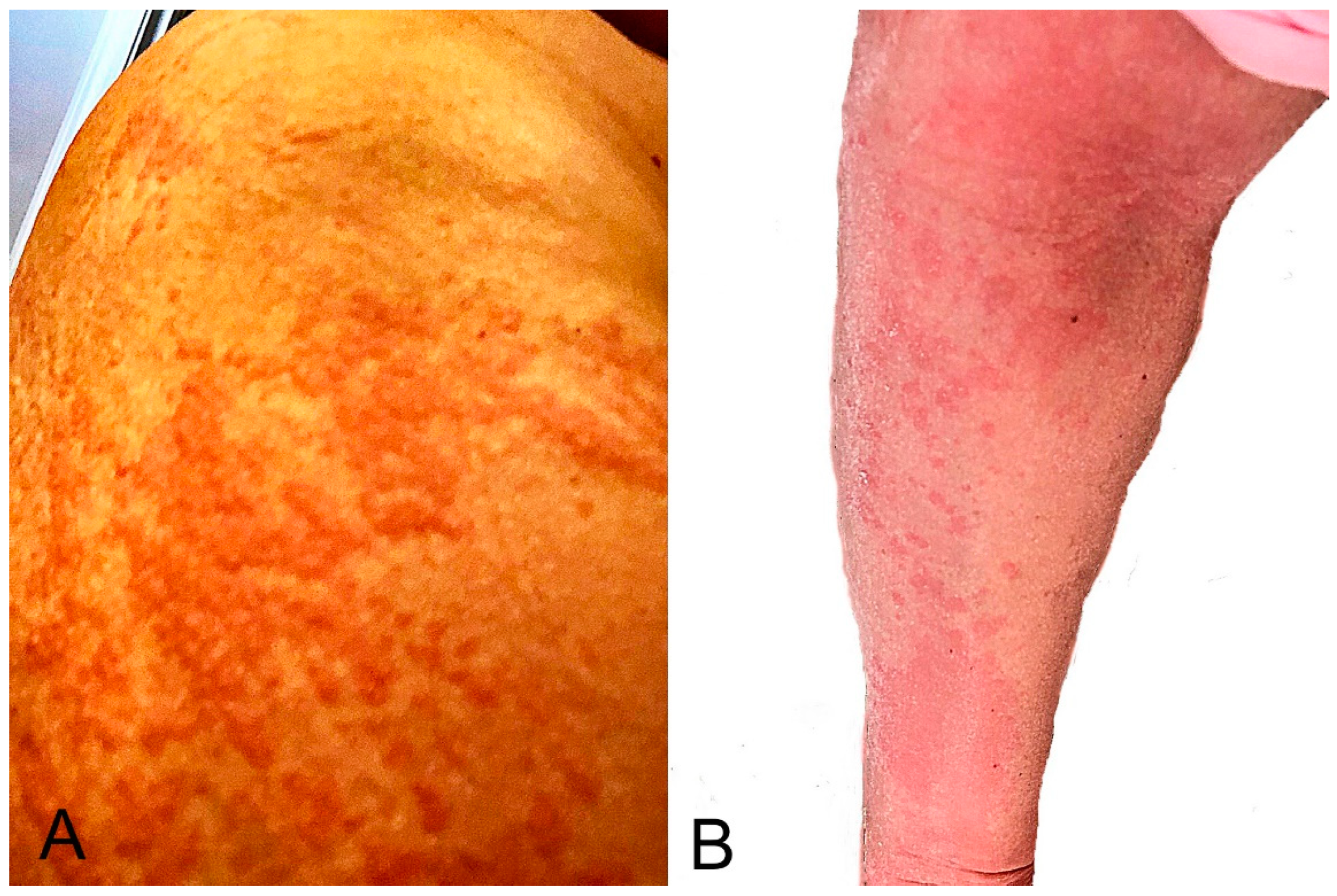 Microorganisms 10 00624 g003