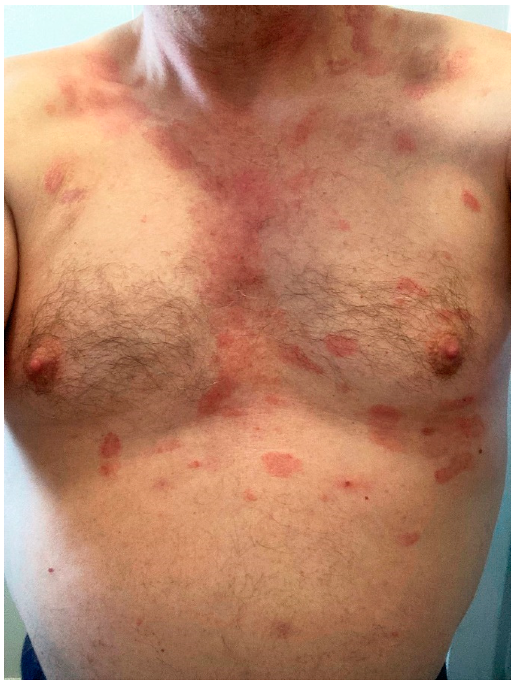 Microorganisms 10 00624 g004