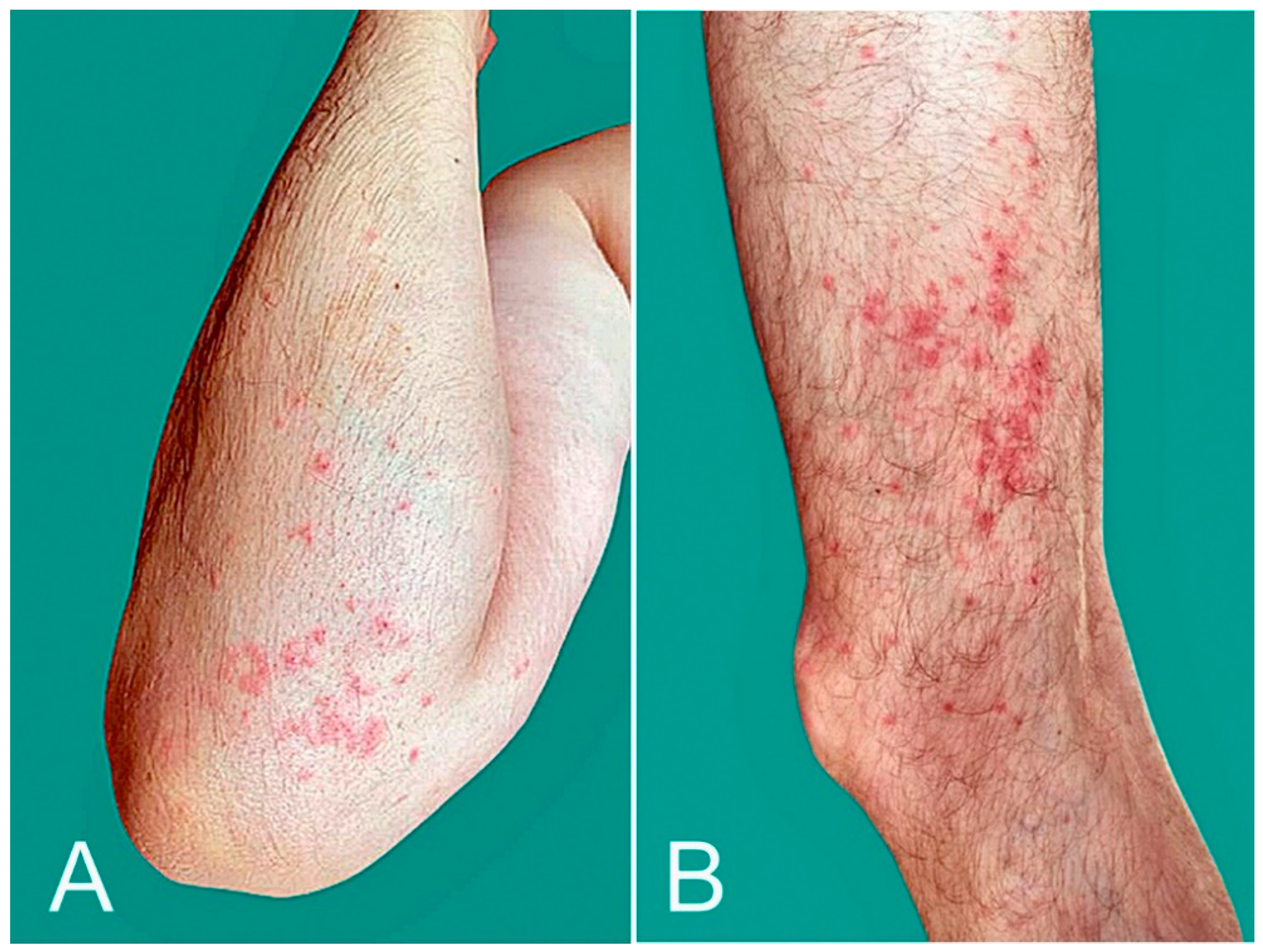 Microorganisms 10 00624 g005