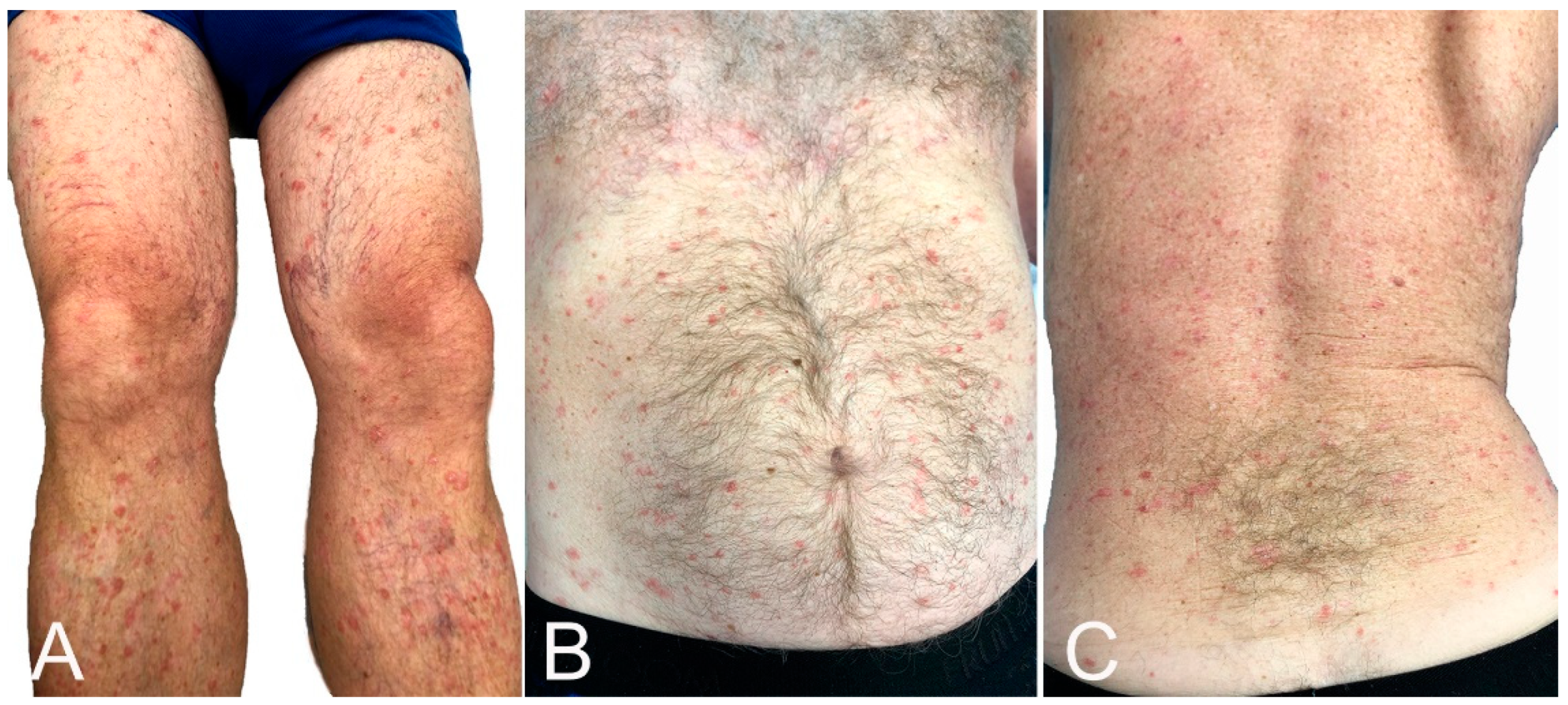 Microorganisms 10 00624 g006