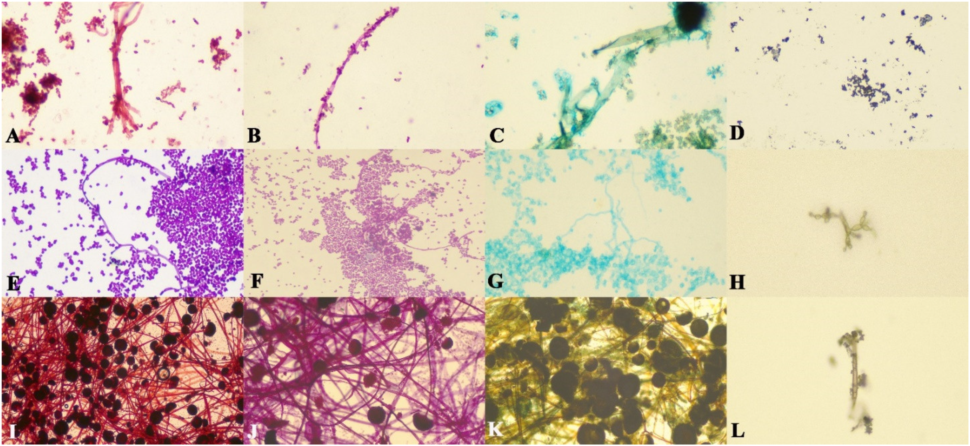 Microorganisms 10 01226 g001