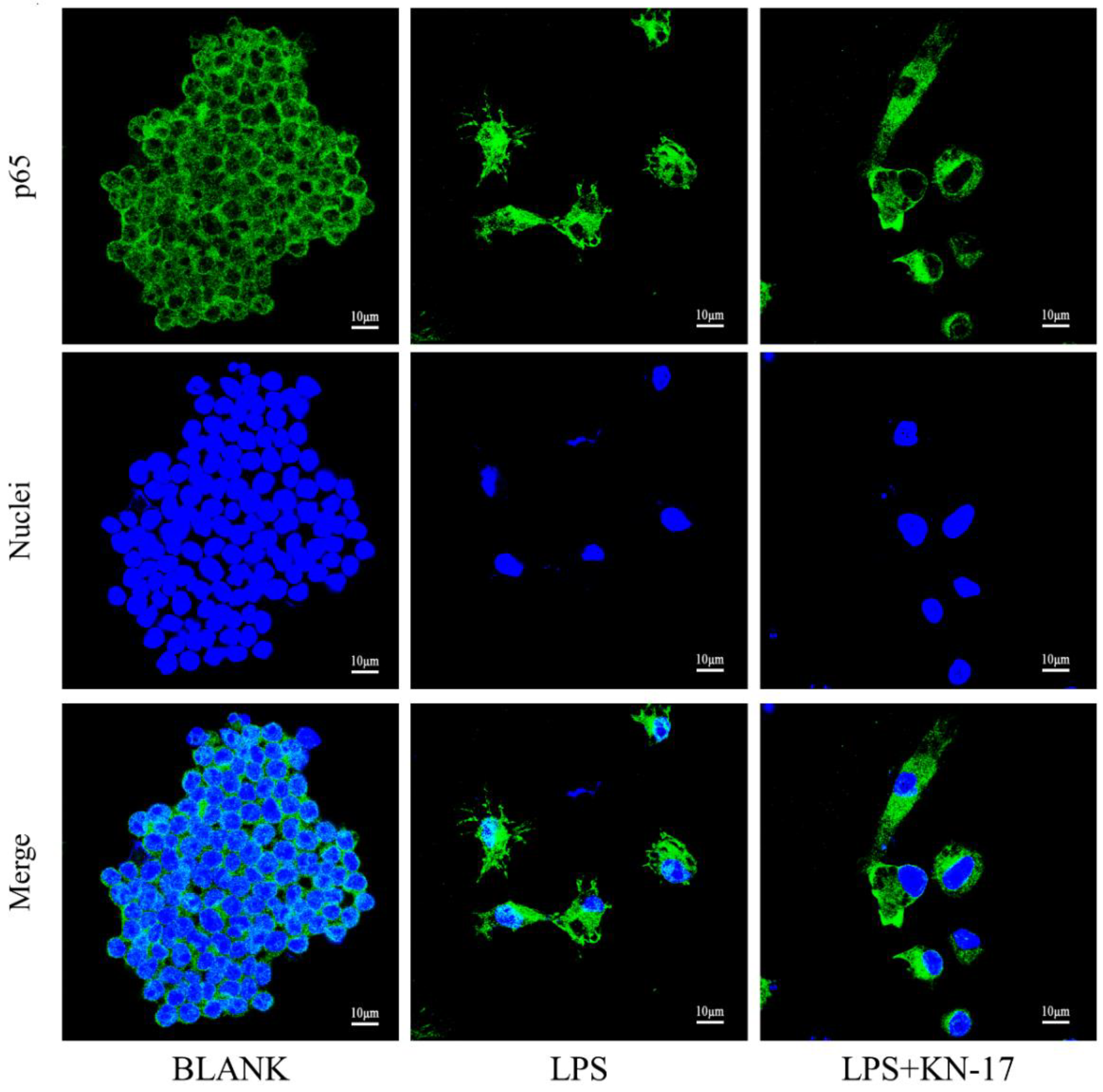 Microorganisms 10 02114 g011