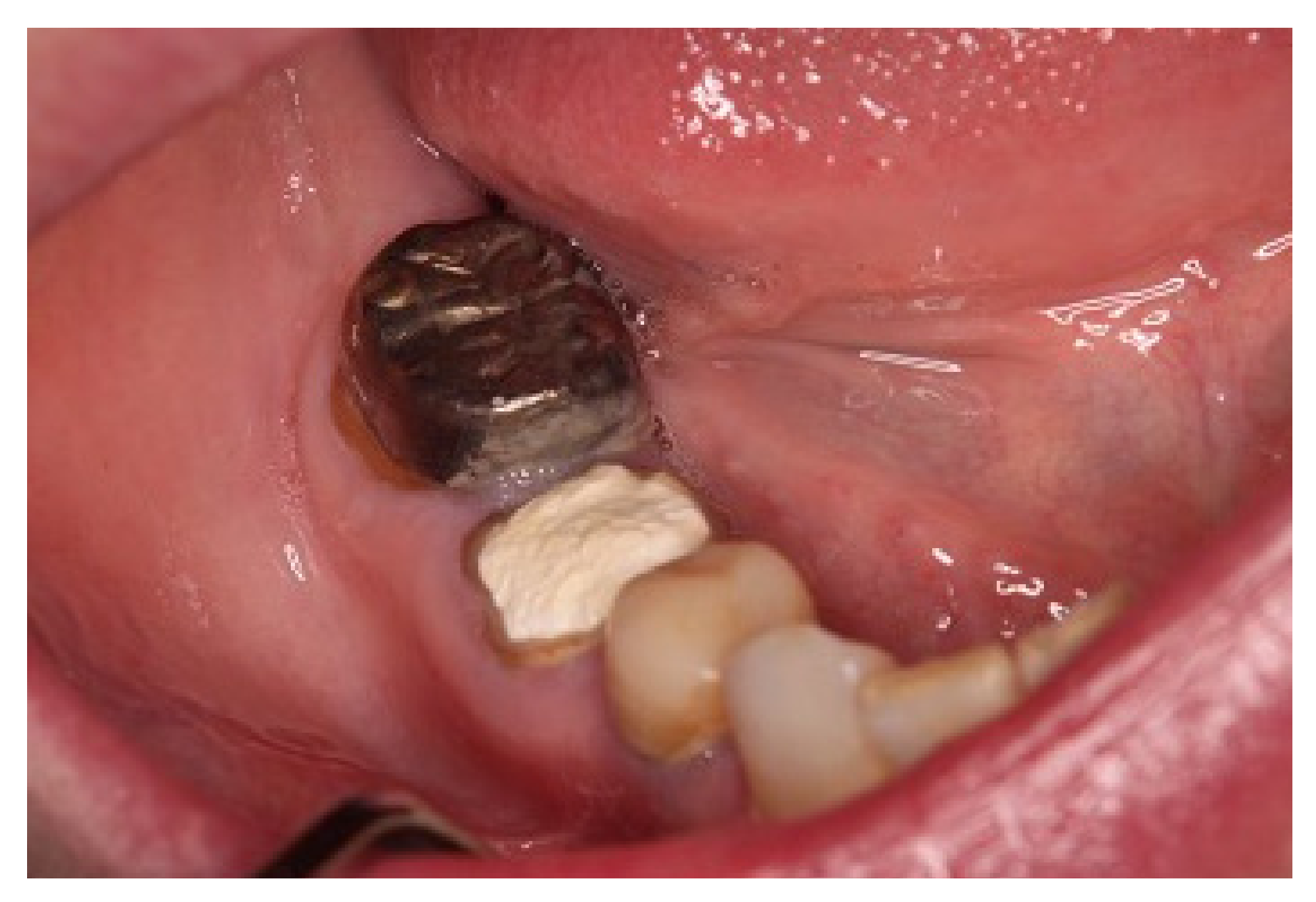 Microorganisms 10 02285 g003