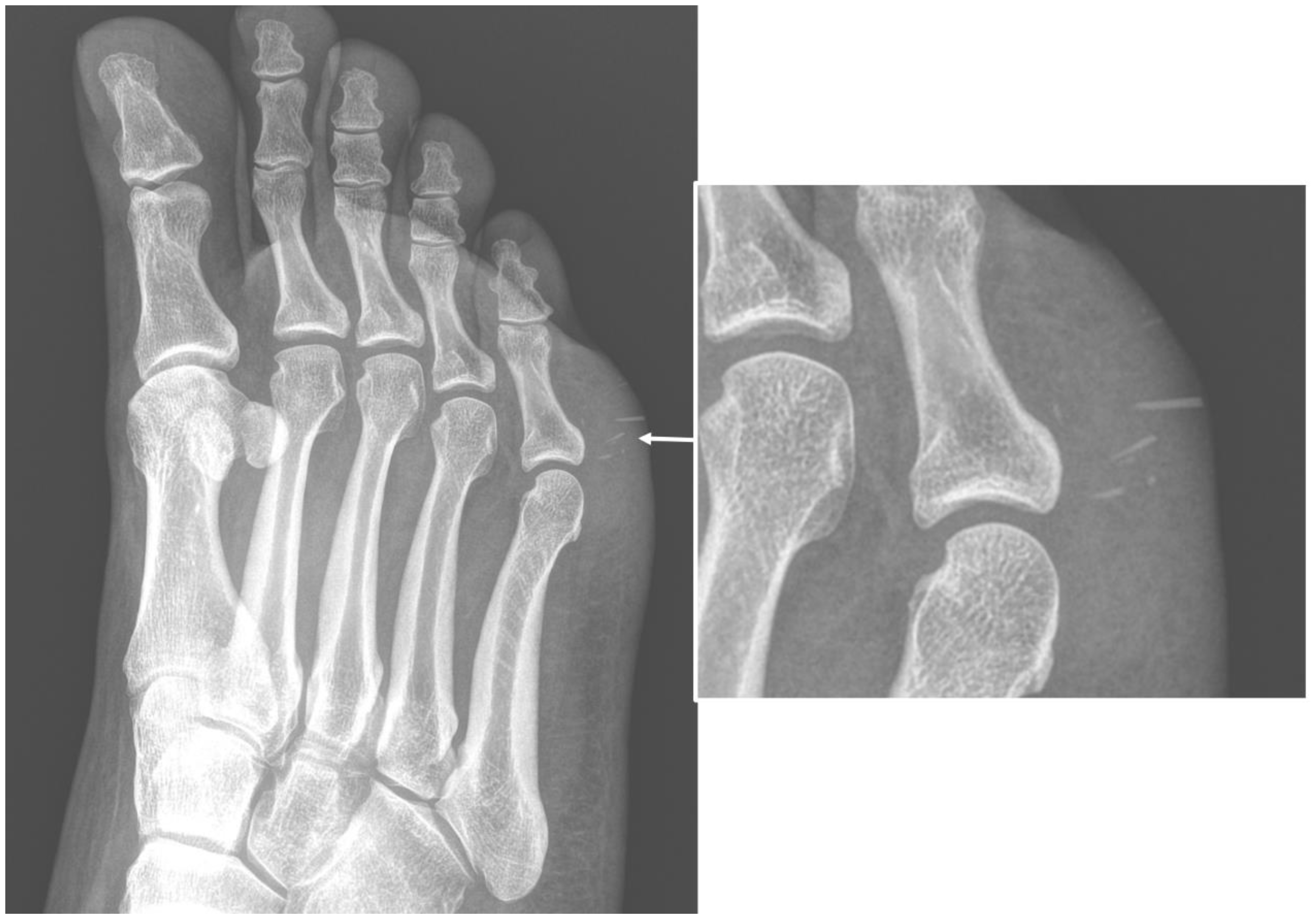 Microorganisms 10 02329 g001
