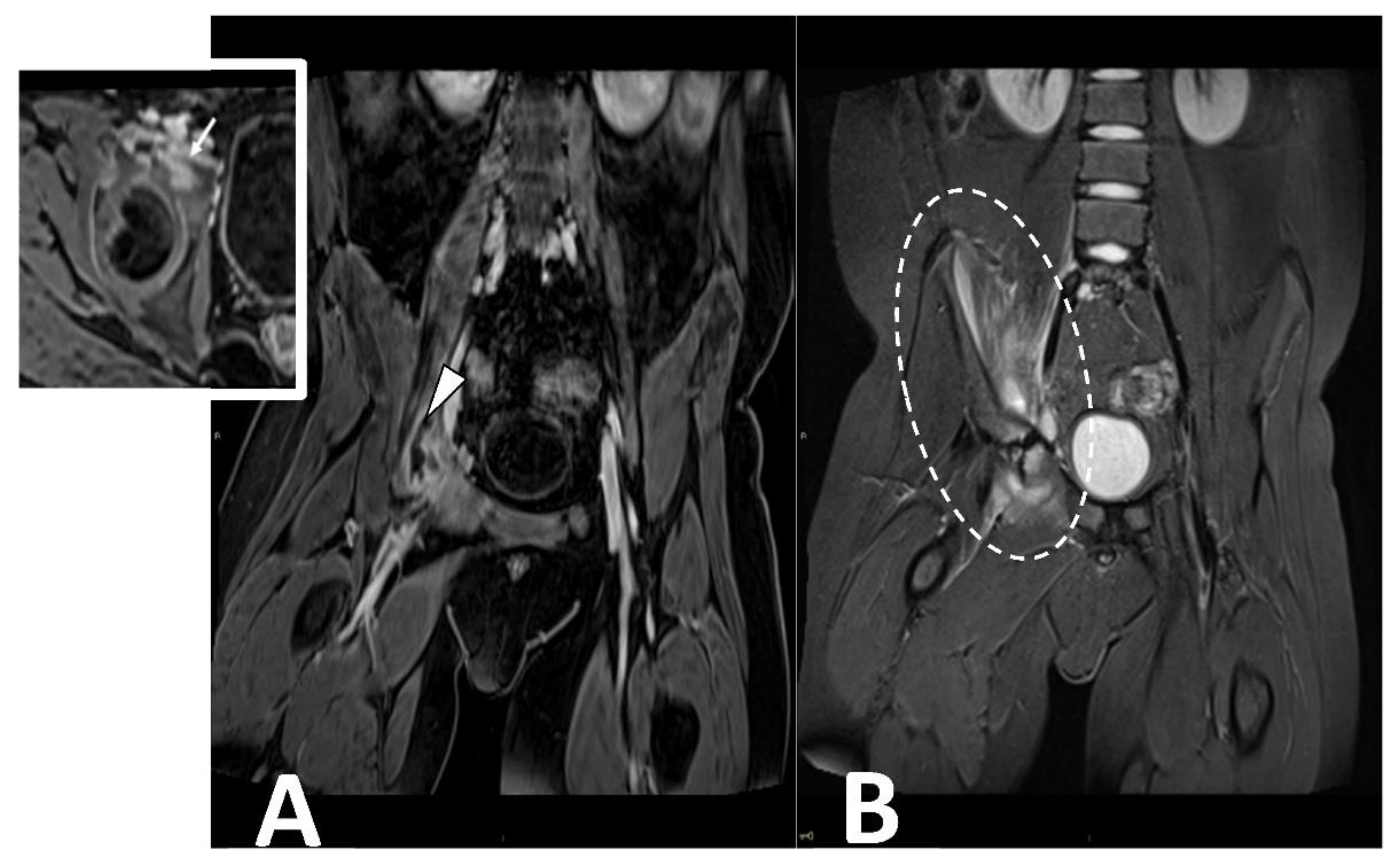 Microorganisms 10 02329 g007