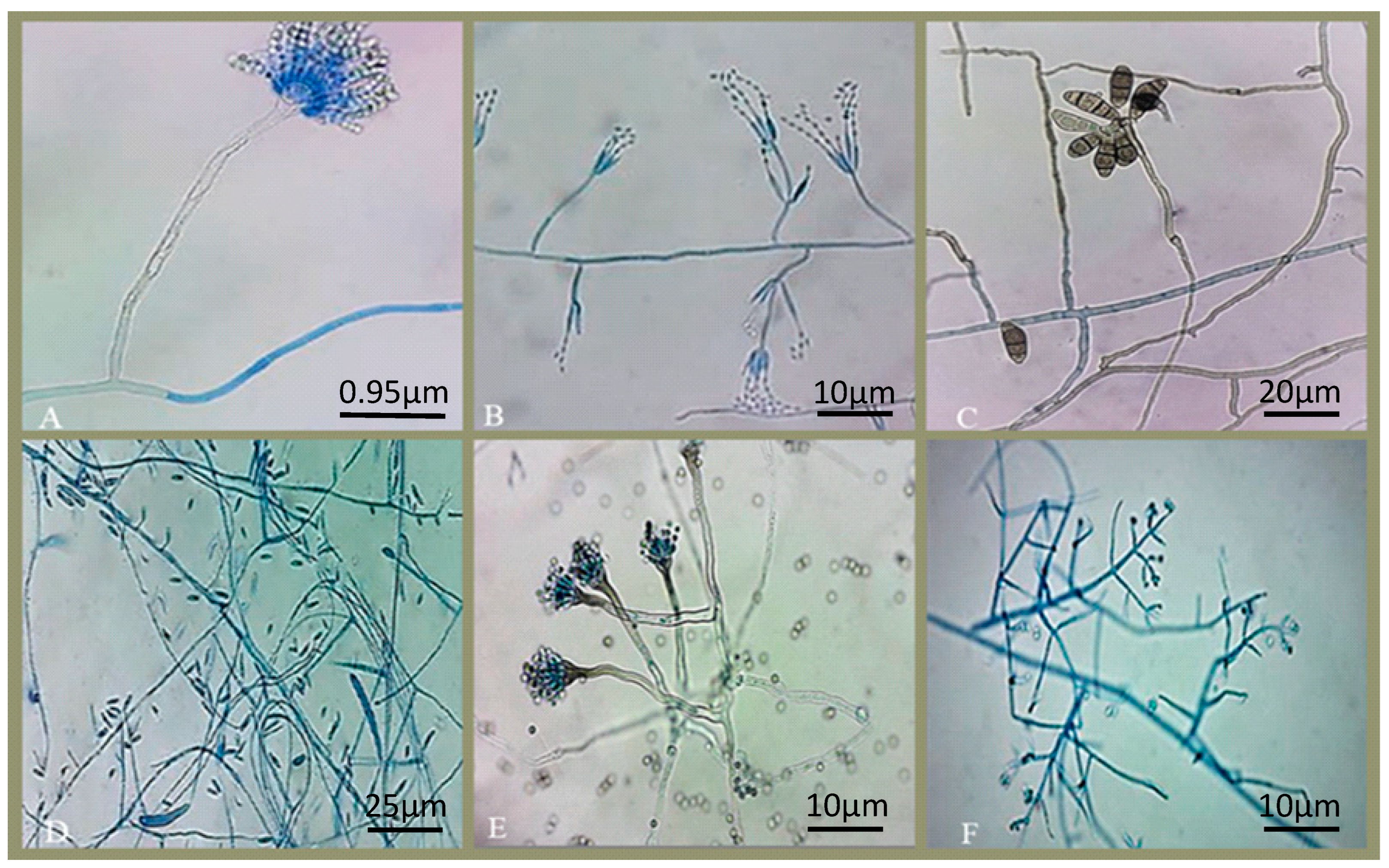 Microorganisms 10 02394 g002