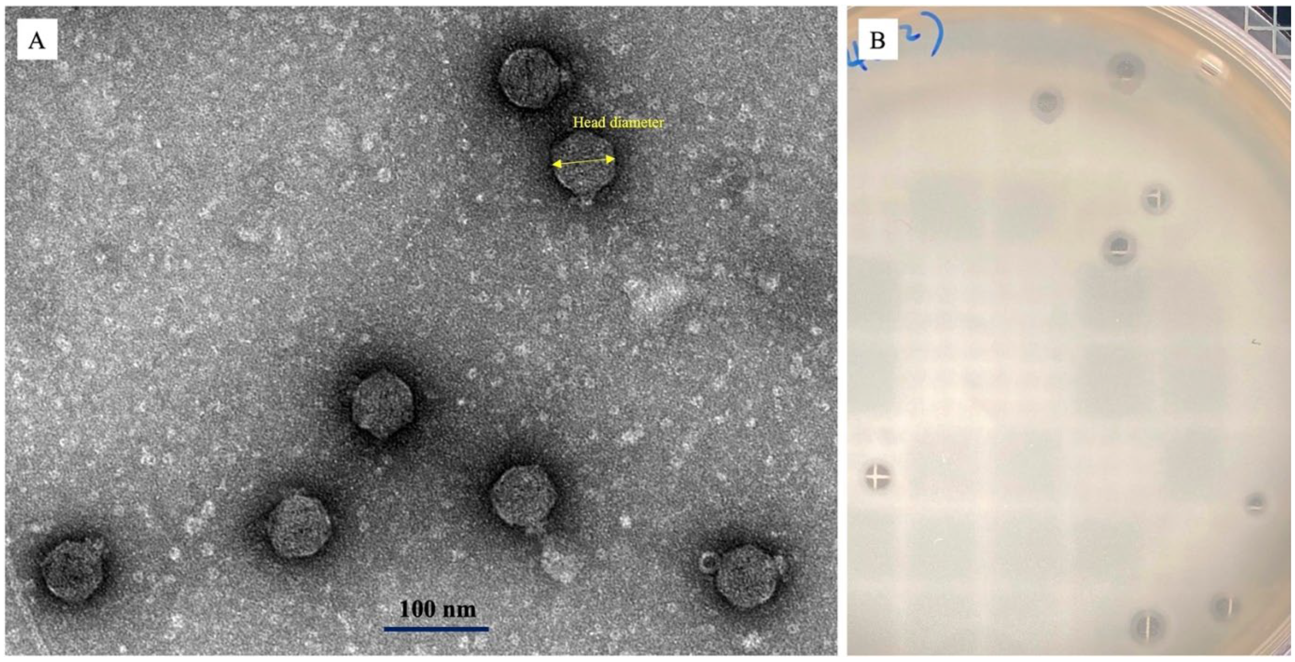 Microorganisms 11 00077 g004