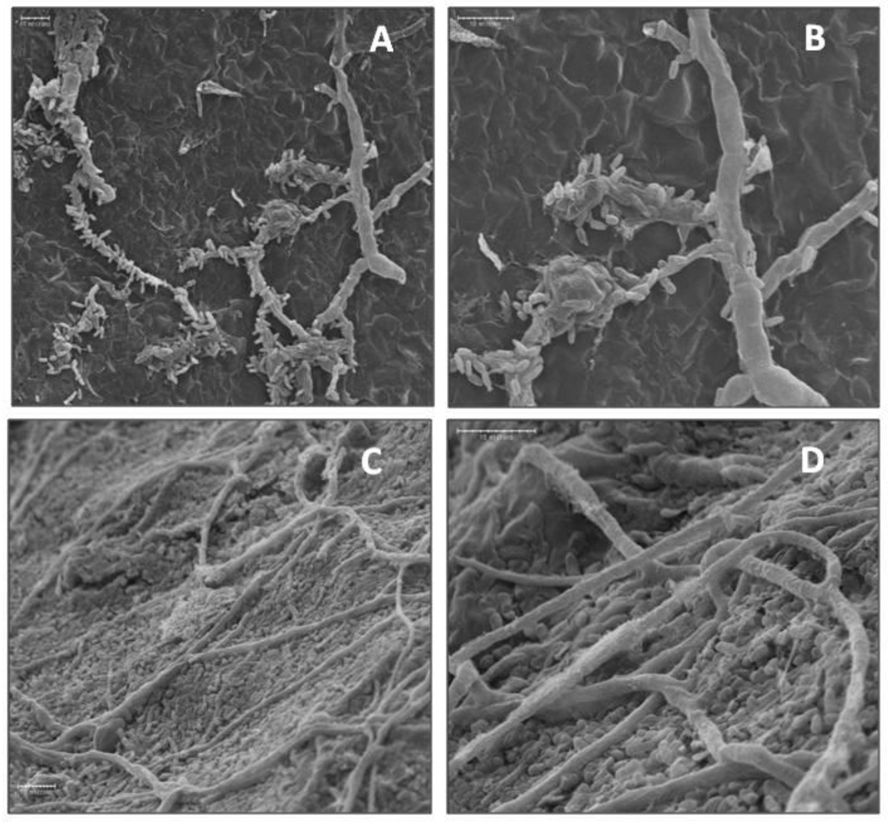 Microorganisms 11 00081 g004