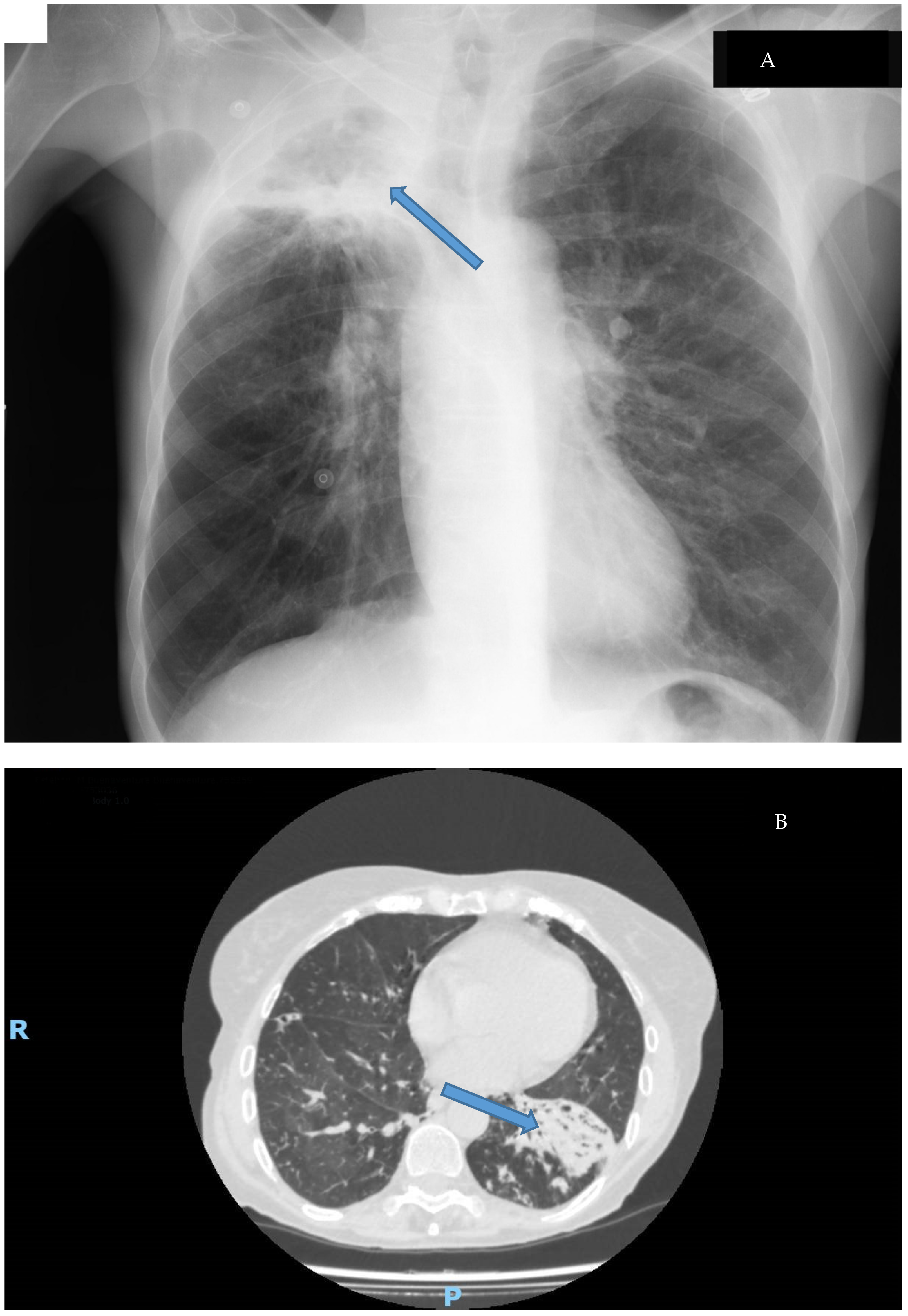 Microorganisms 11 00090 g004