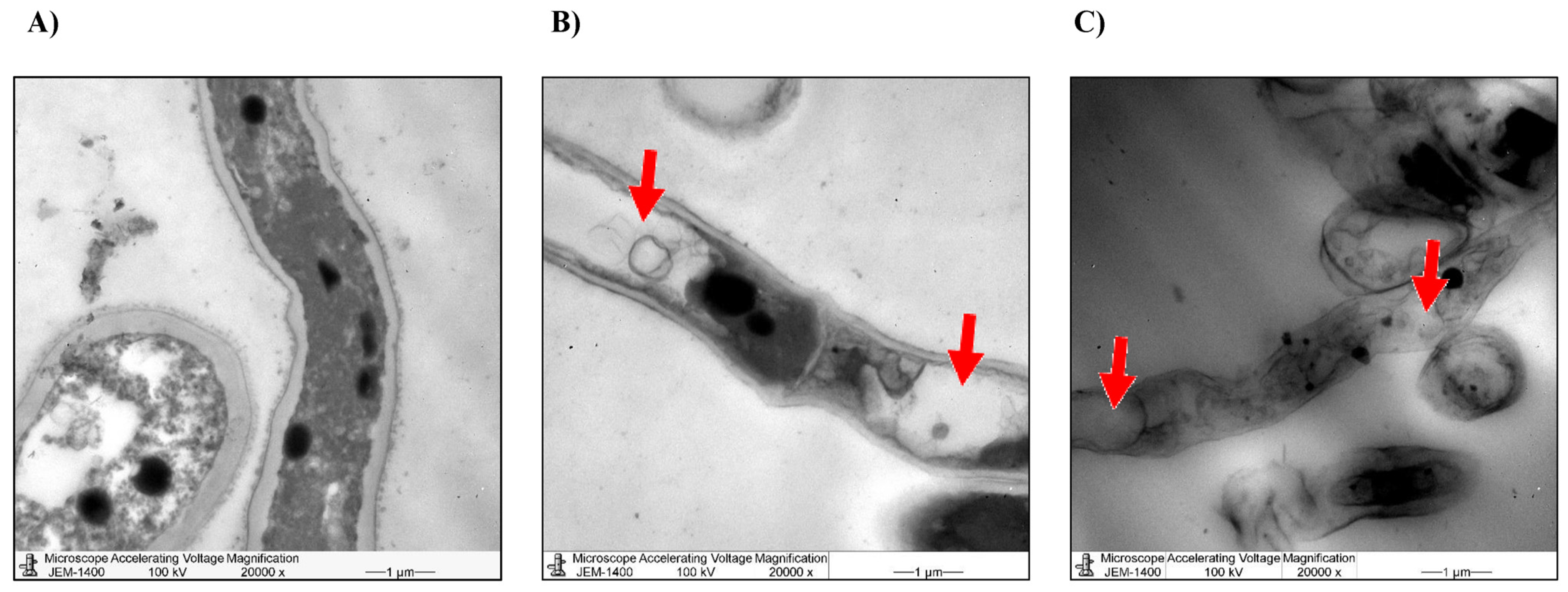 Microorganisms 11 00127 g008
