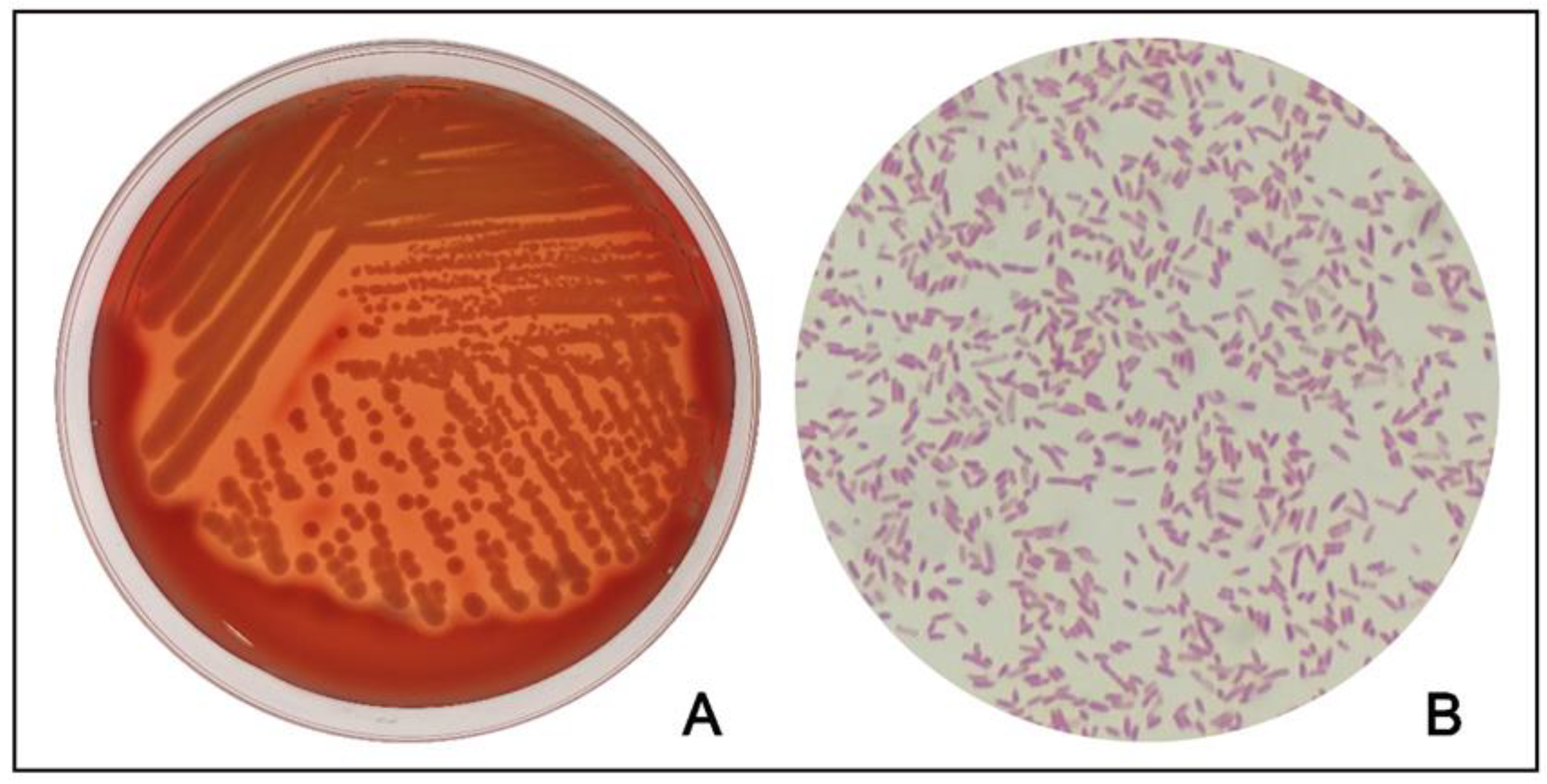 Microorganisms 11 00333 g003